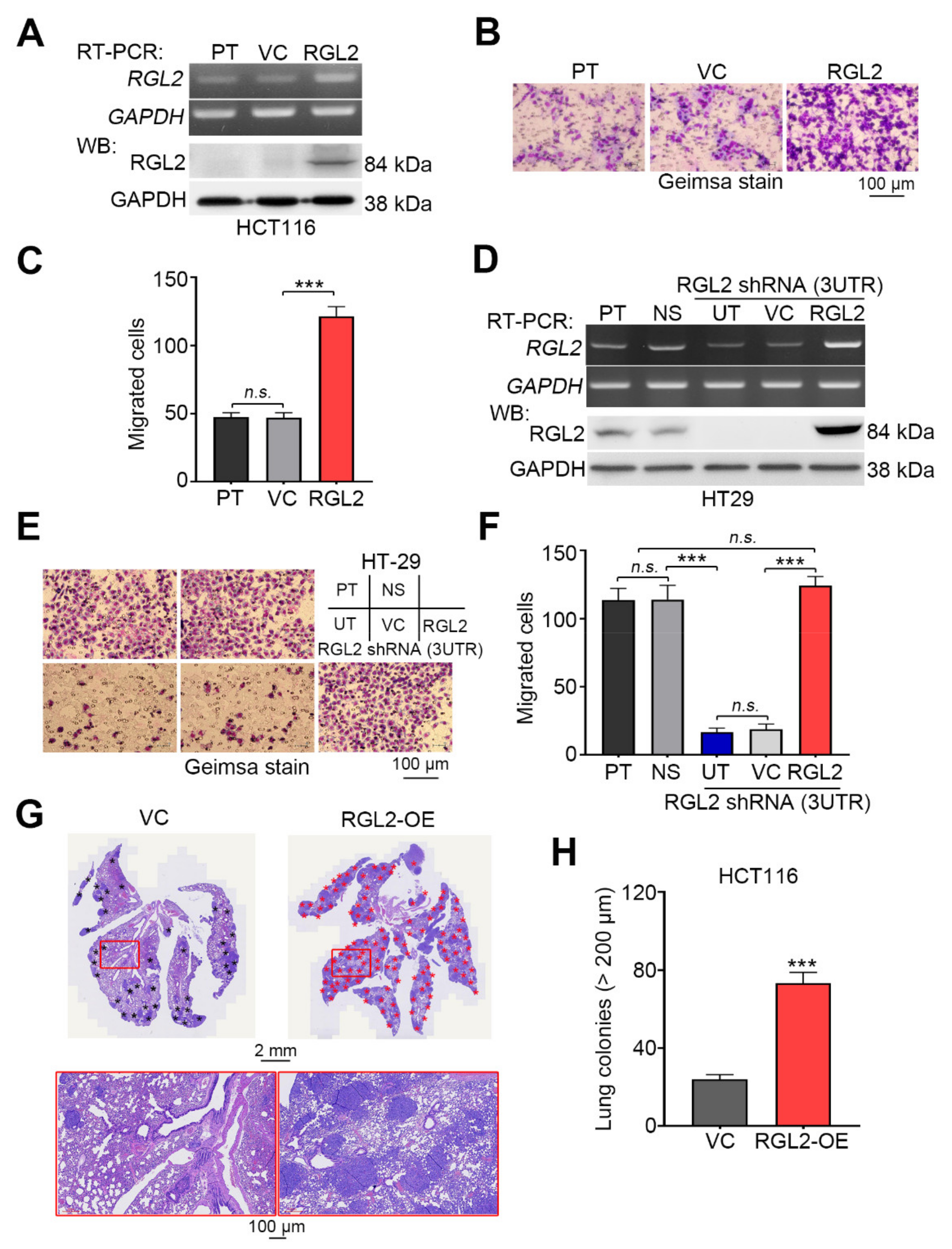 Cancers Free Full Text Rgl2 Drives The Metastatic Progression Of Colorectal Cancer Via Preventing The Protein Degradation Of B Catenin And Kras Html