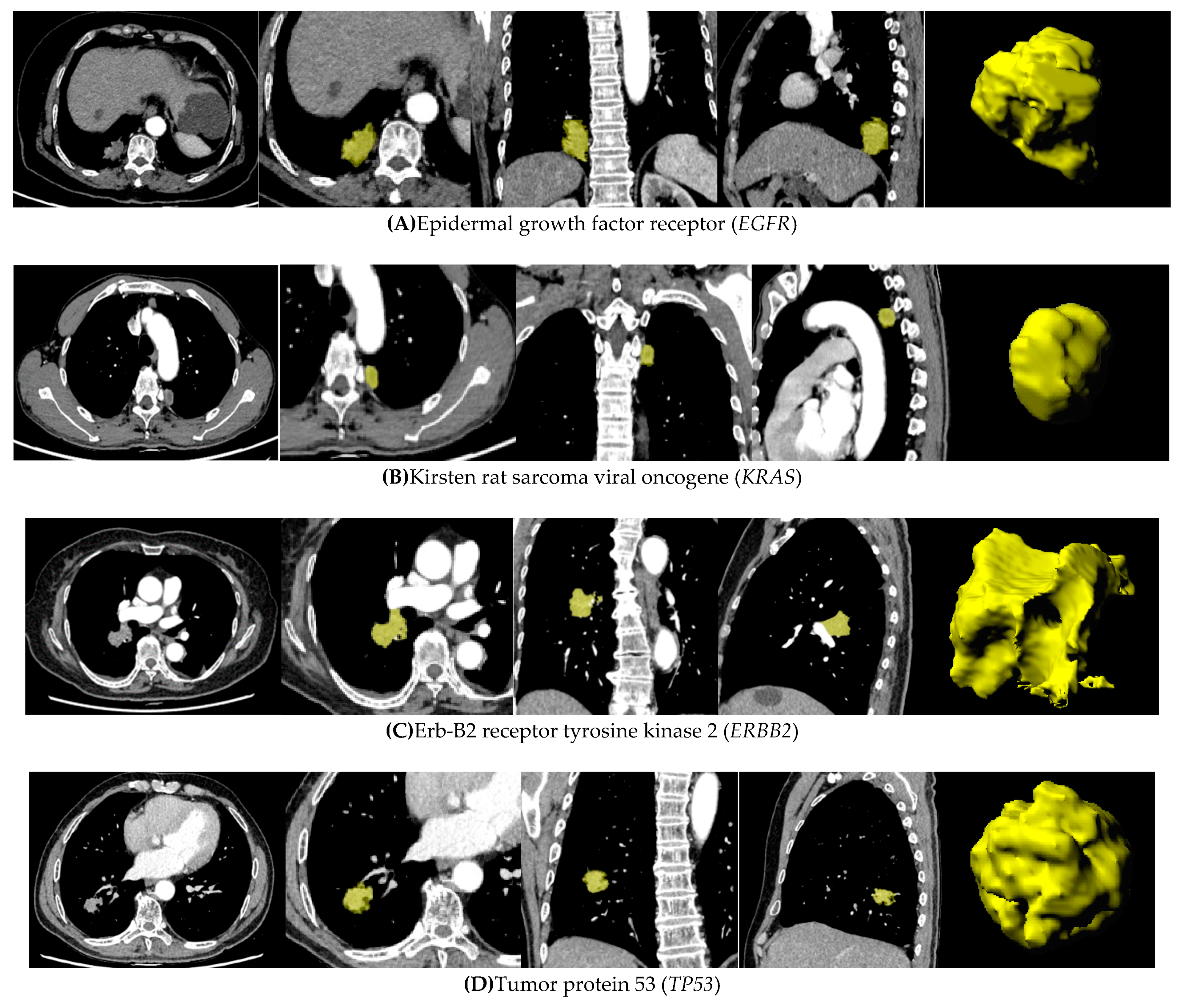 Cancers 13 01814 g005