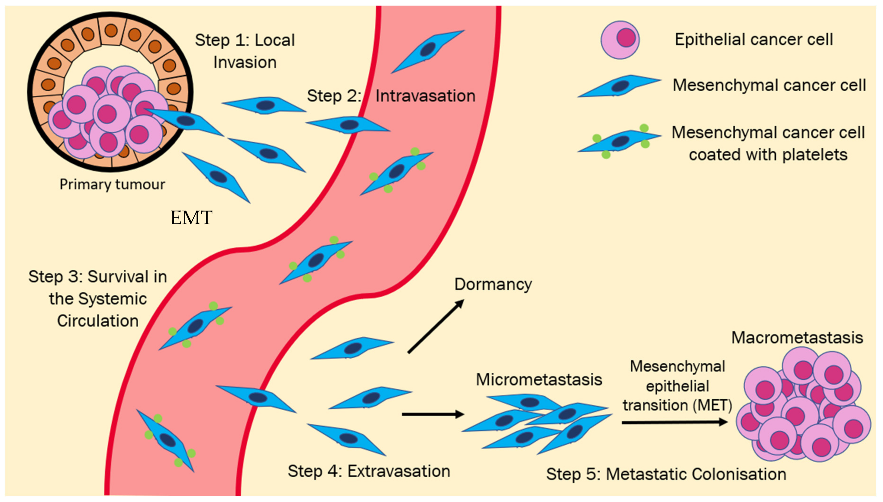 Cancers | Free Full-Text | Cytoskeletal Dynamics in Epithelial-Mesenchymal  Transition: Insights into Therapeutic Targets for Cancer Metastasis | HTML
