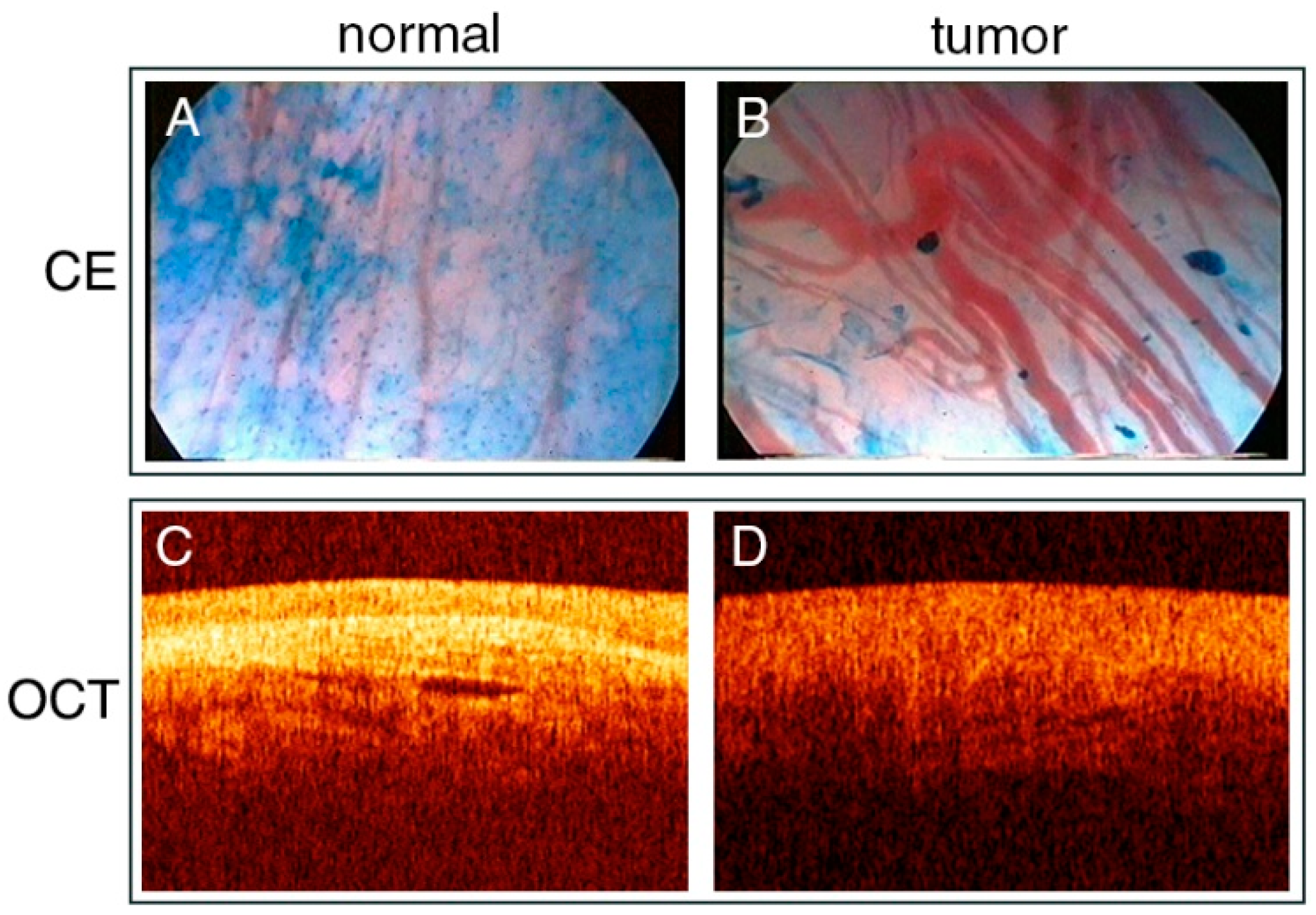 Cancers 13 01895 g003