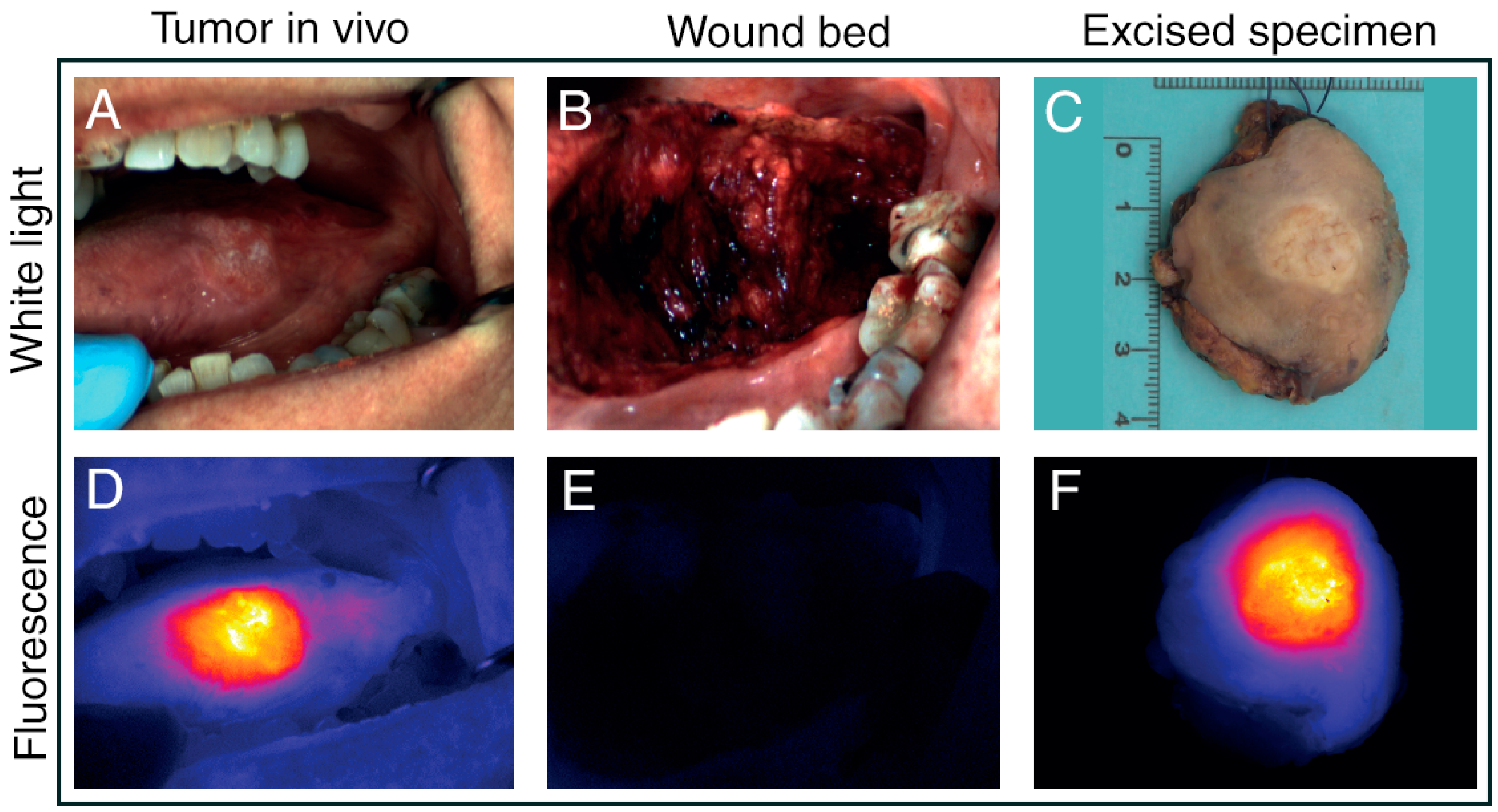 Cancers 13 01895 g004