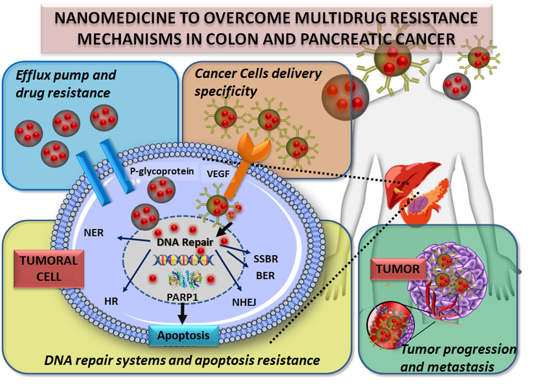 Cancers | Free Full-Text | Nanomedicine to Overcome Multidrug Resistance  Mechanisms in Colon and Pancreatic Cancer: Recent Progress | HTML