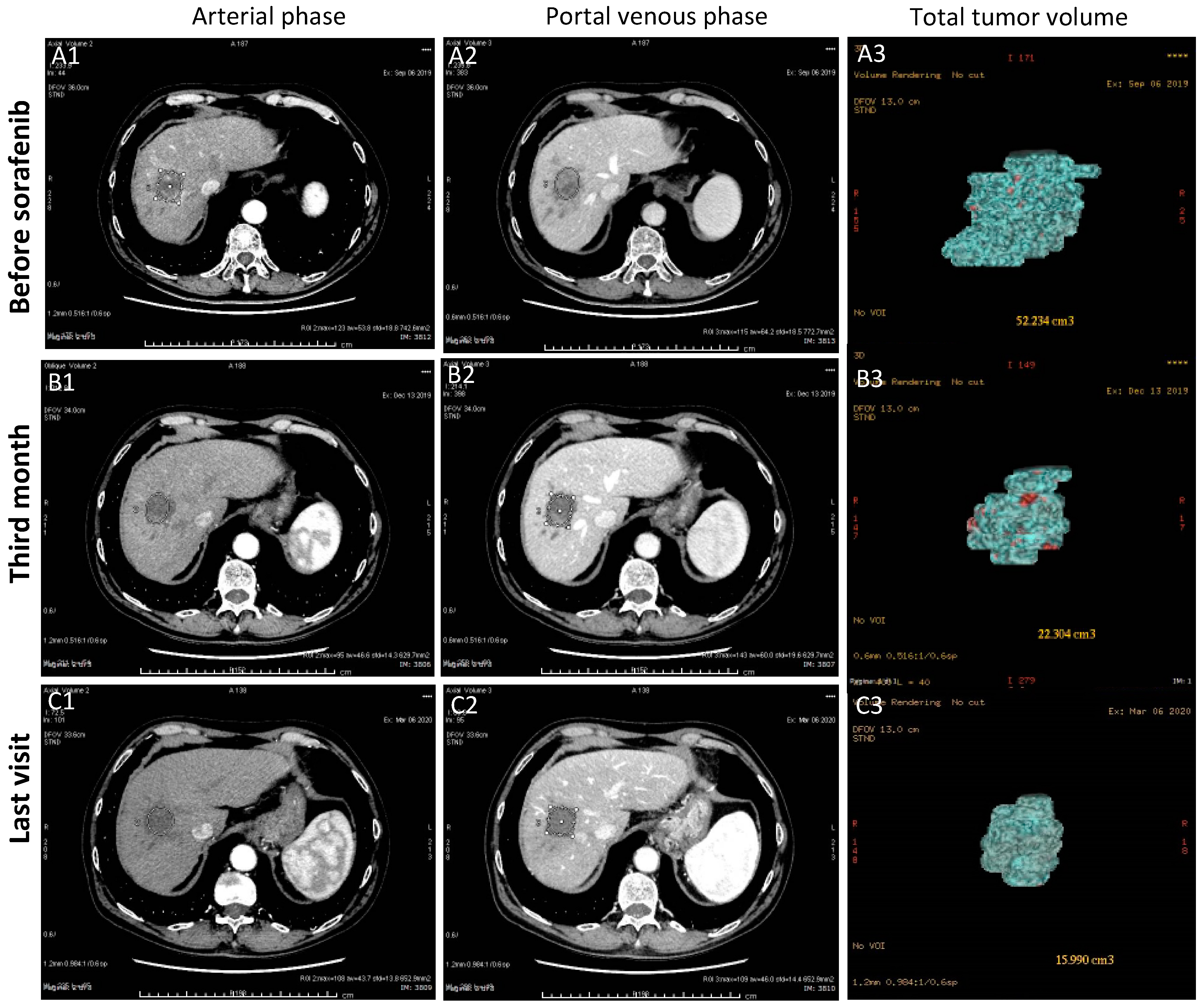 Cancers 13 02064 g005 Cancers 13 02064 g005