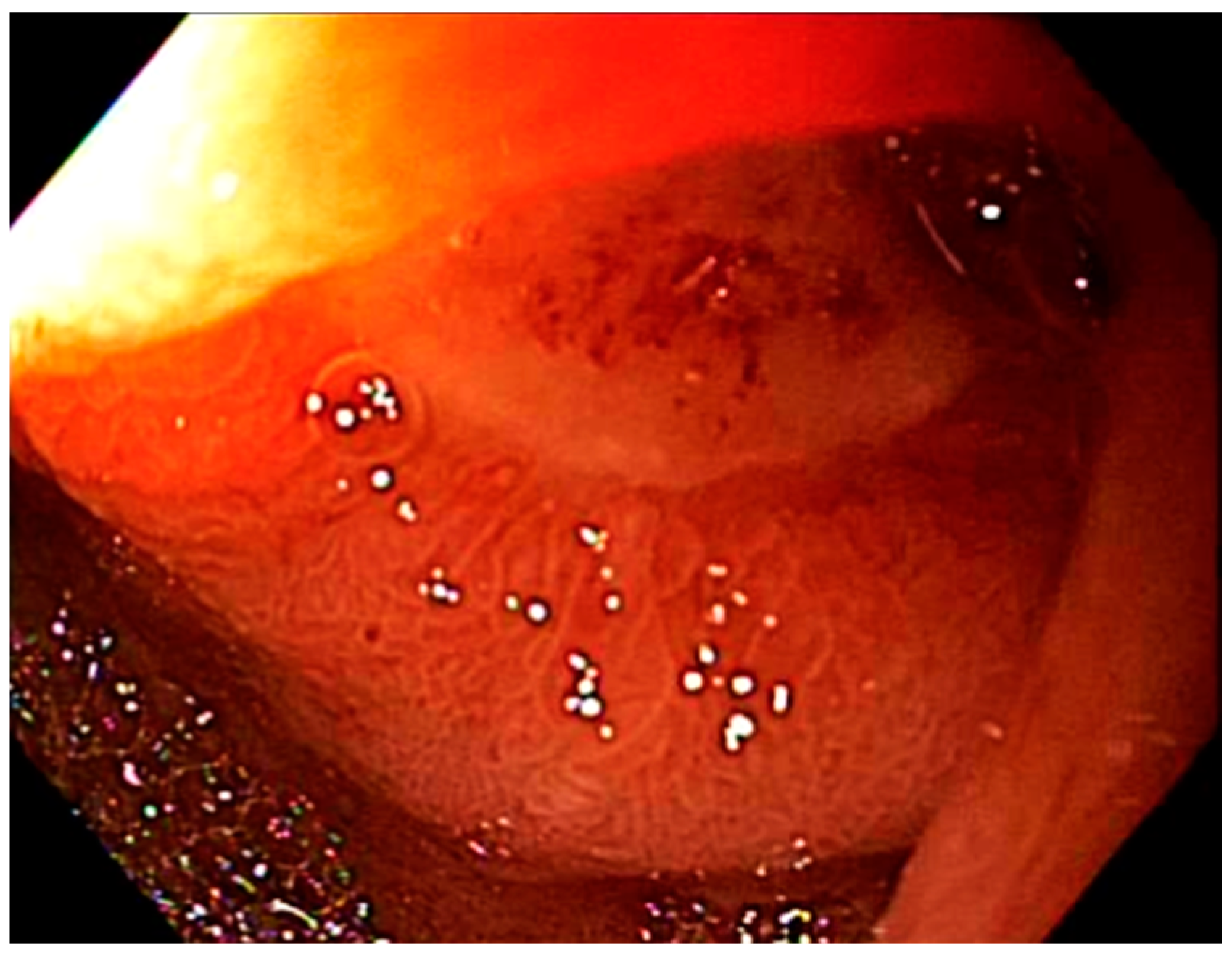 Cancers 13 02136 g003 Cancers 13 02136 g003