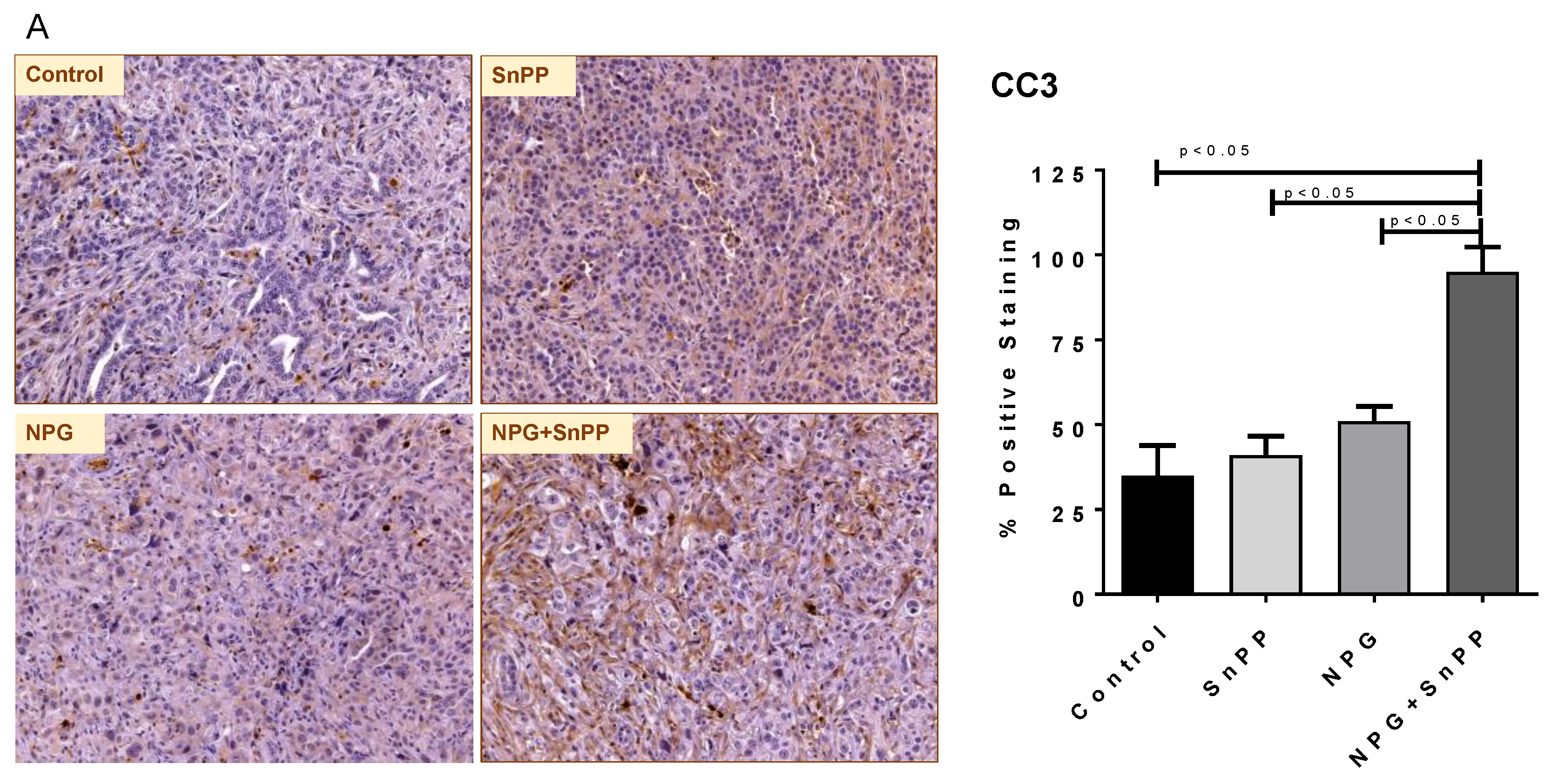 Cancers 13 02264 g009a Cancers 13 02264 g009a