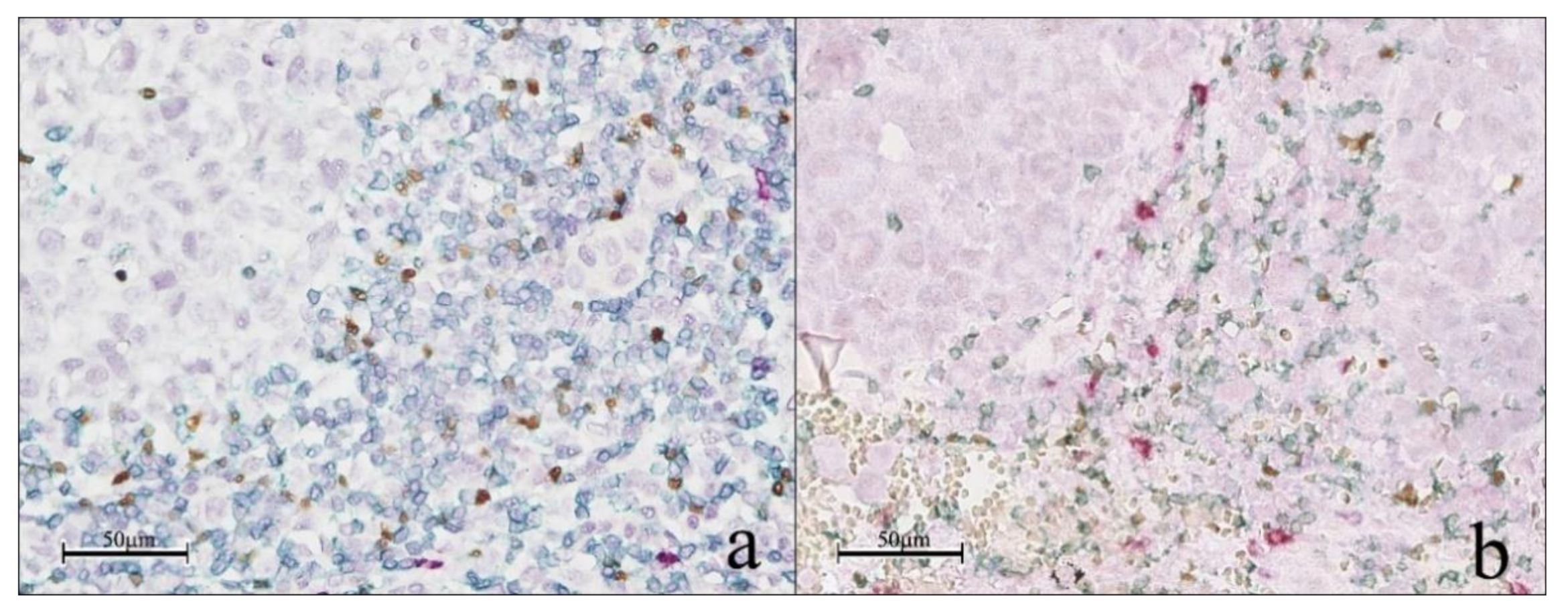 Cancers 13 02325 g002 Cancers 13 02325 g002