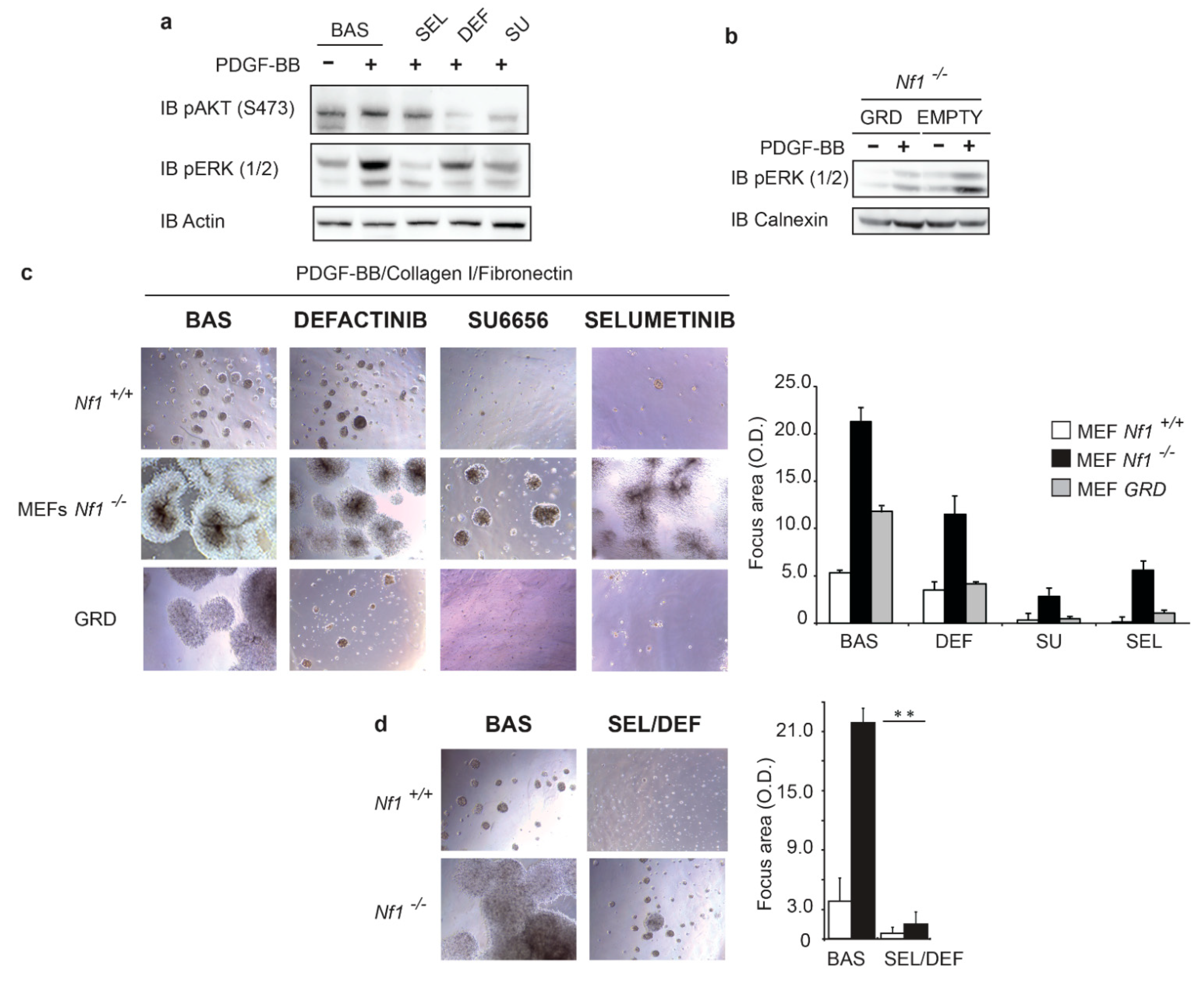 Cancers 13 02329 g003