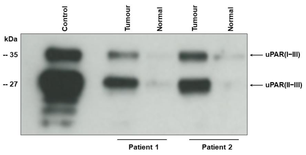 Cancers 13 02377 g001 Cancers 13 02377 g001