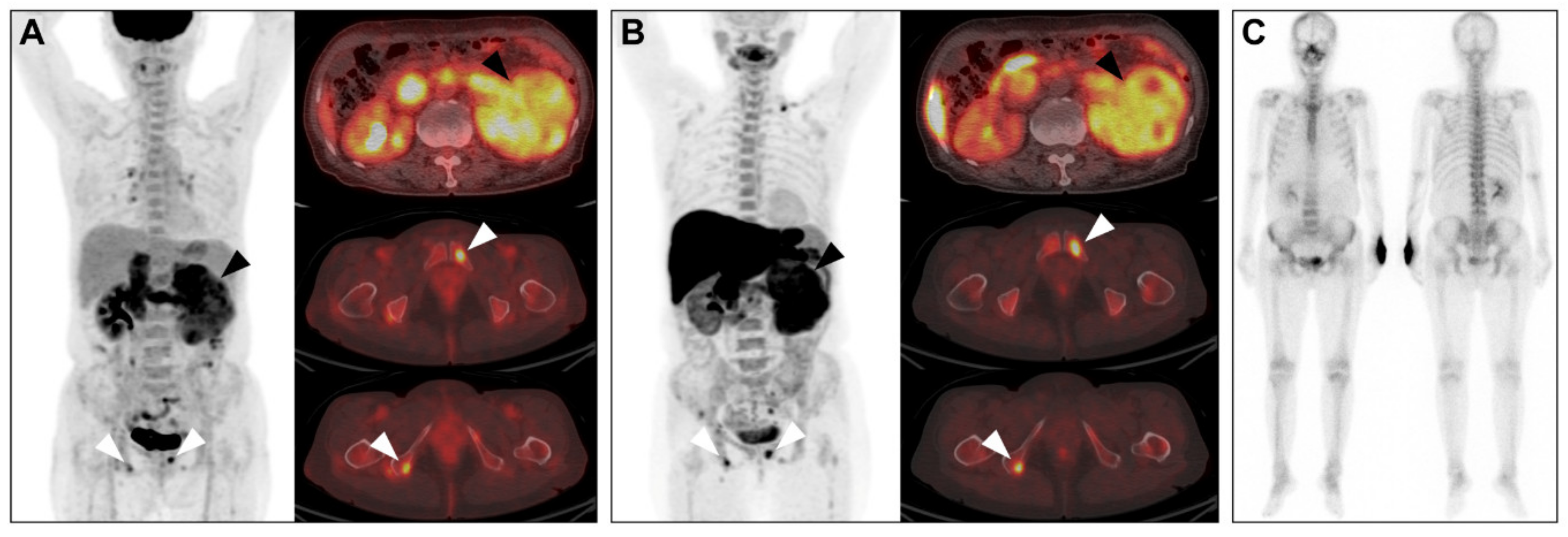 Cancers 13 02381 g002 Cancers 13 02381 g002
