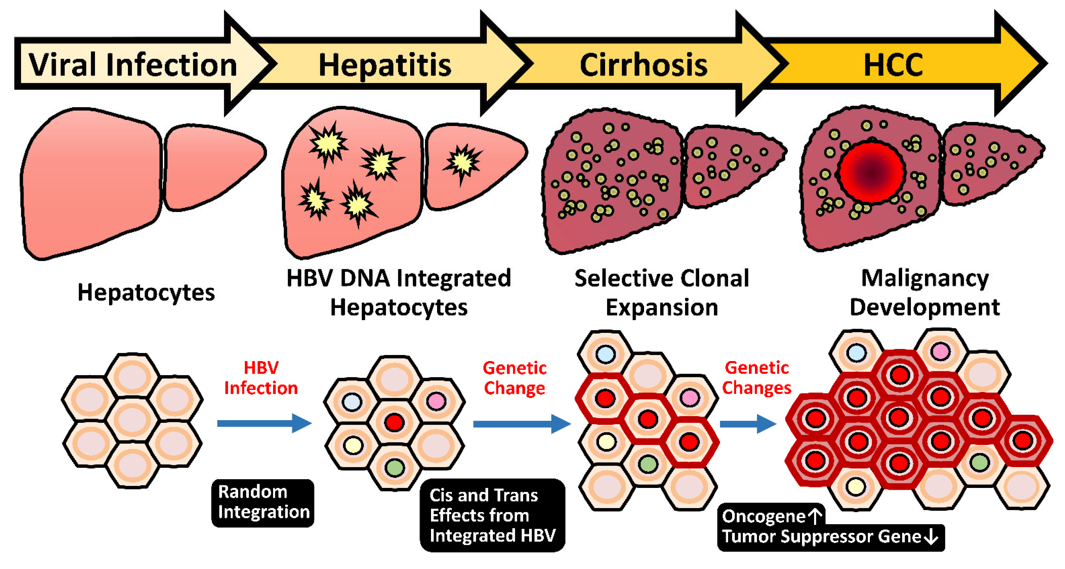 Hbv гепатит. HBV инфекция. Viral Hepatitis. HBV вирус. Autoimmune Hepatitis pathogenesis.
