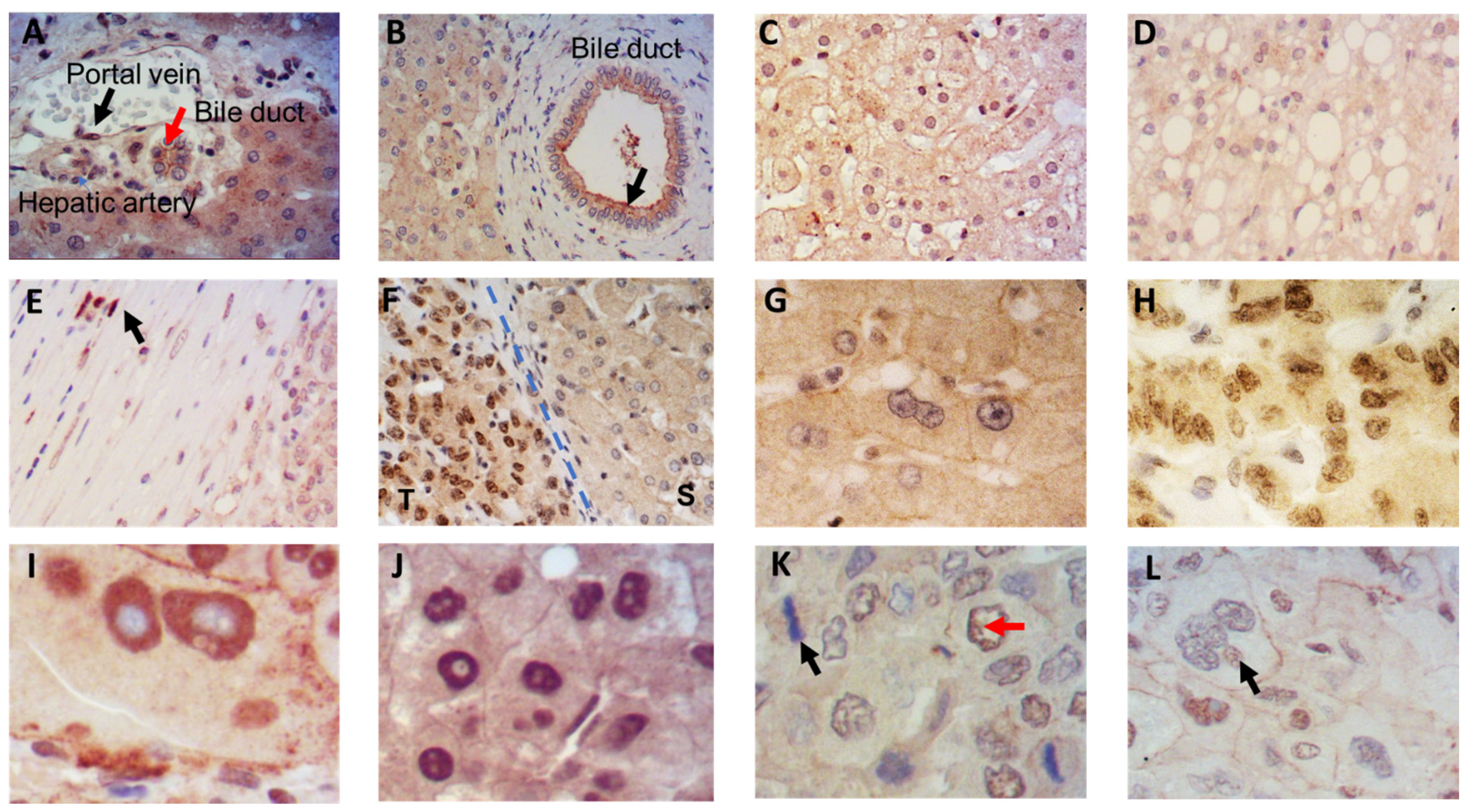 Cancers 13 02560 g001