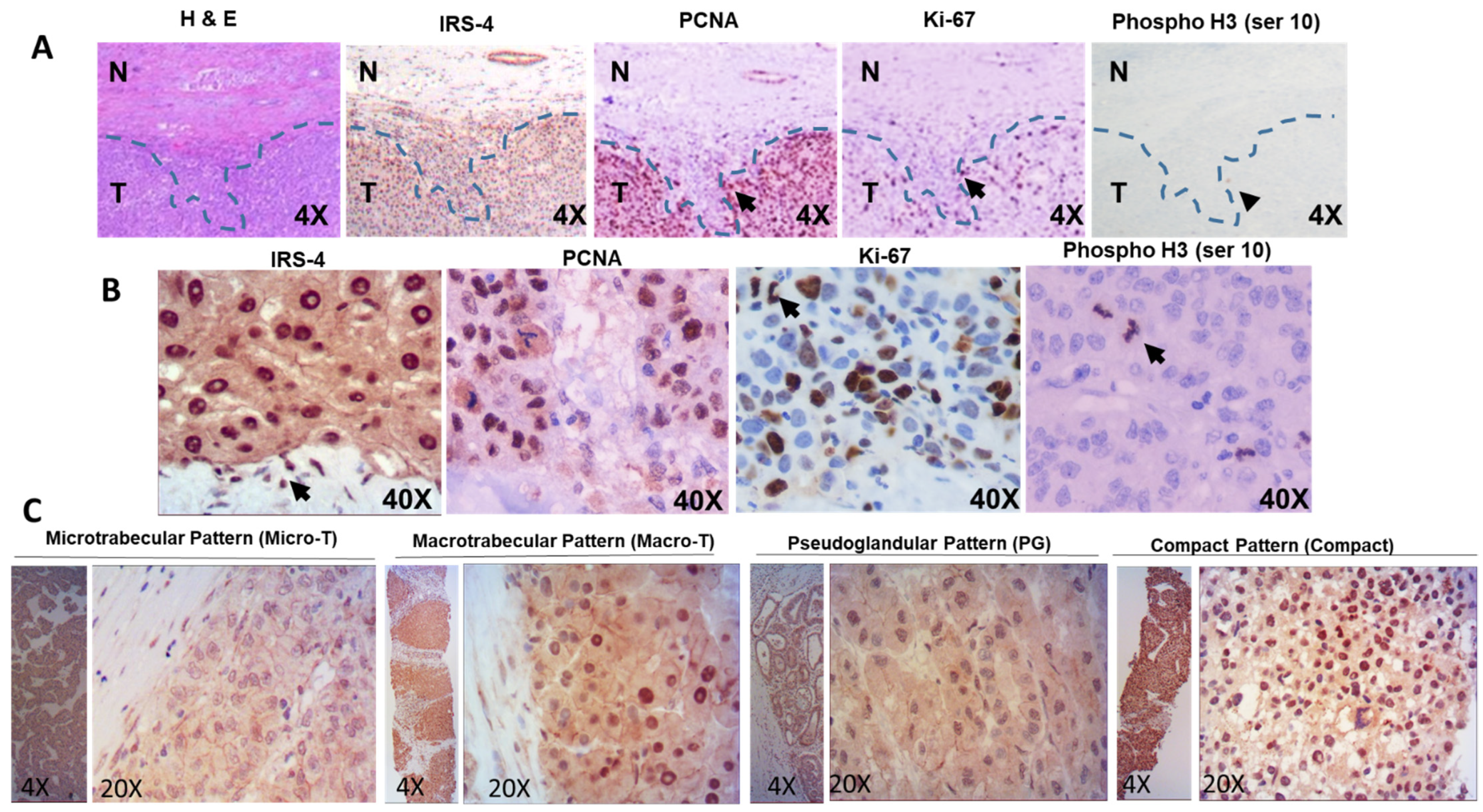 Cancers 13 02560 g002