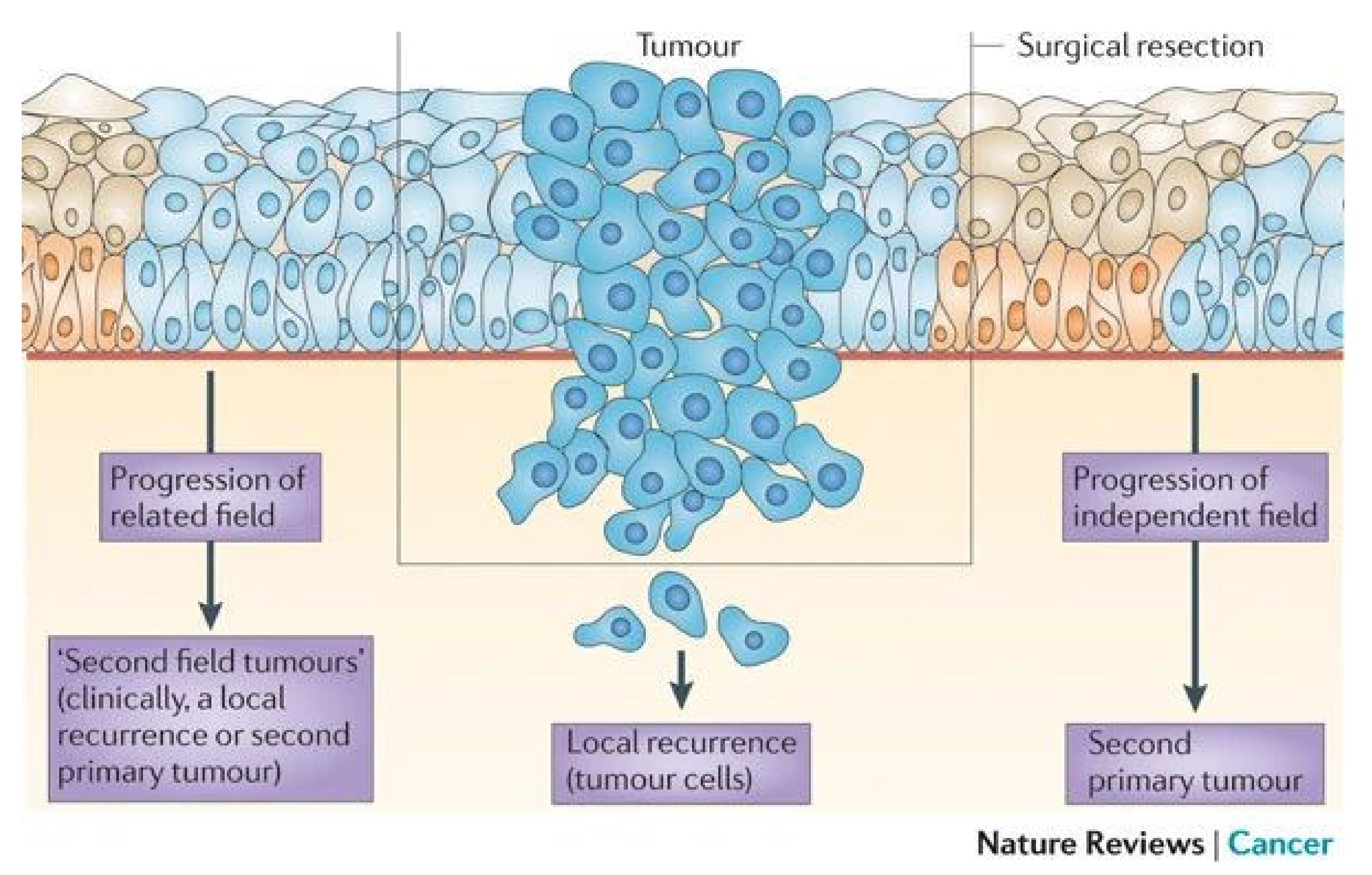 Cancers | Free Full-Text | Resection Margins in Head and Neck Cancer  Surgery: An Update of Residual Disease and Field Cancerization