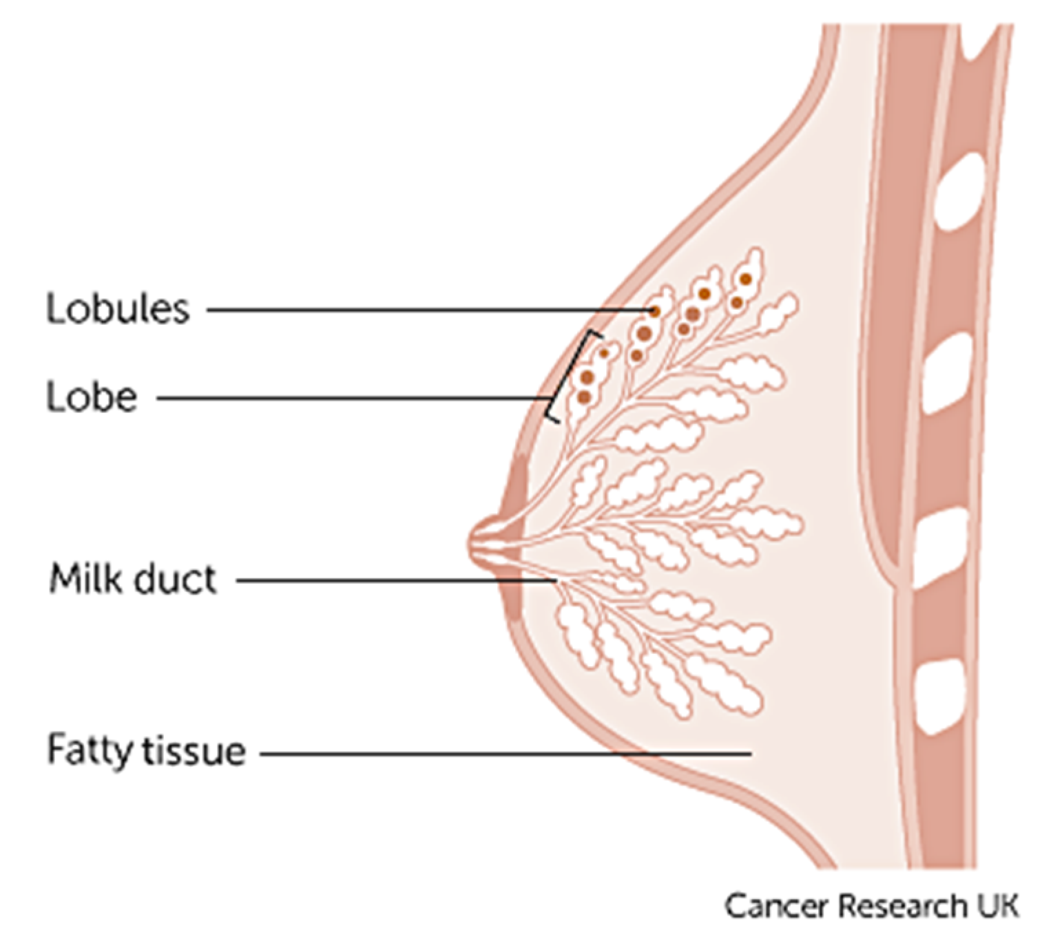 Understanding Your Breast Cancer Diagnosis: A Guide - OWise UK
