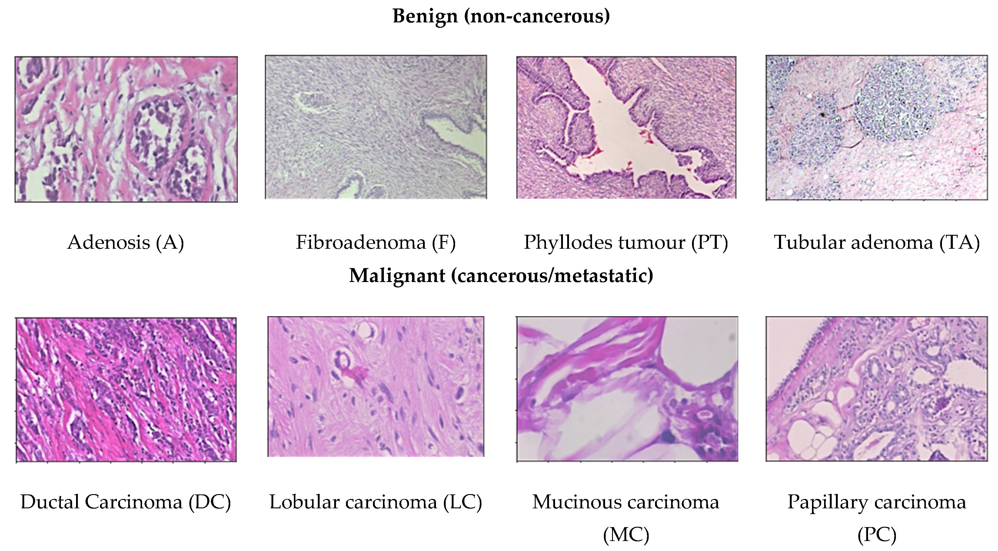 Cancers 13 02764 g005 Cancers 13 02764 g005