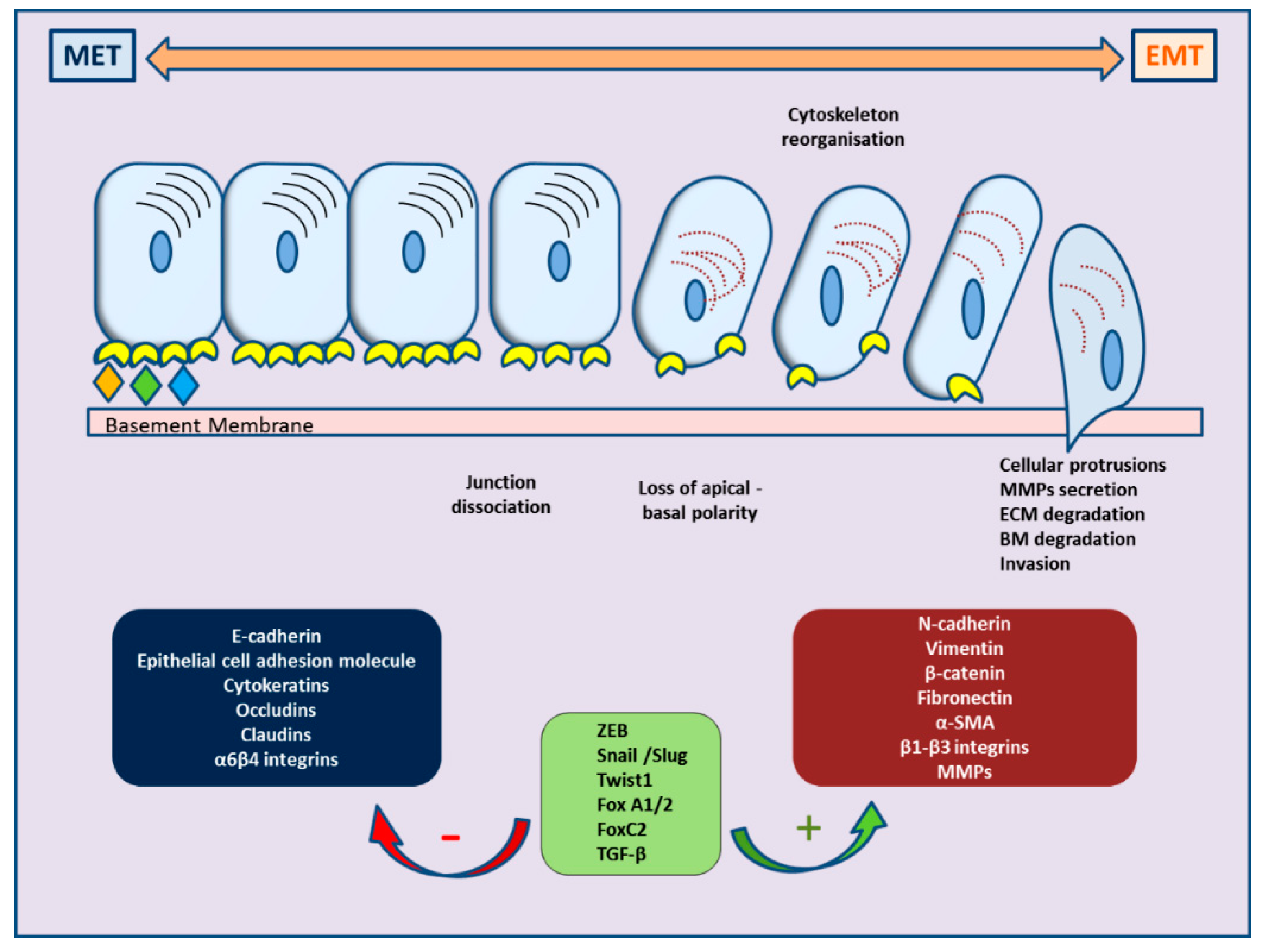 Cancers | Free Full-Text | Cell Plasticity and Prostate Cancer: The Role of  Epithelial–Mesenchymal Transition in Tumor Progression, Invasion,  Metastasis and Cancer Therapy Resistance