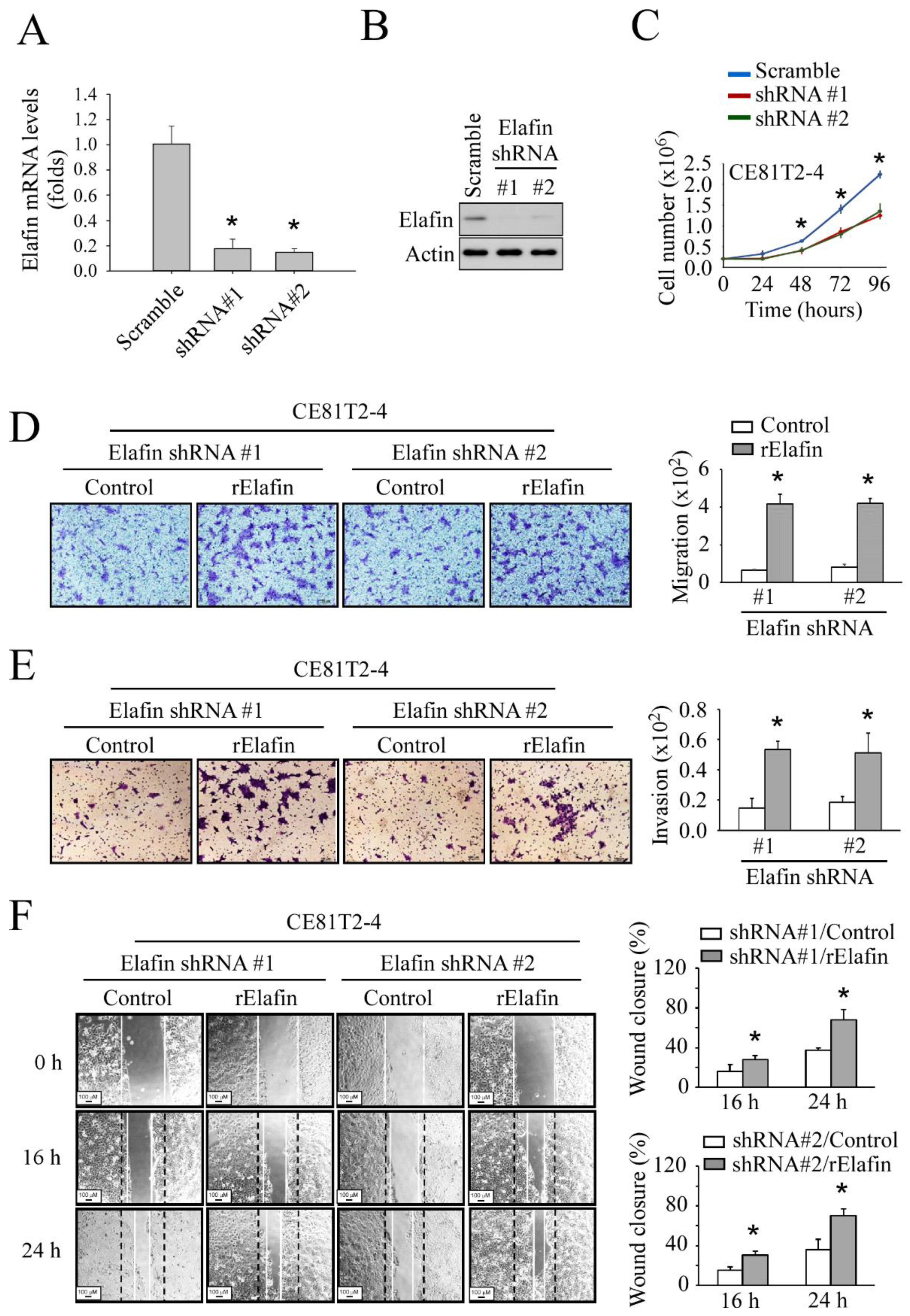 Cancers 13 03082 g004 Cancers 13 03082 g004