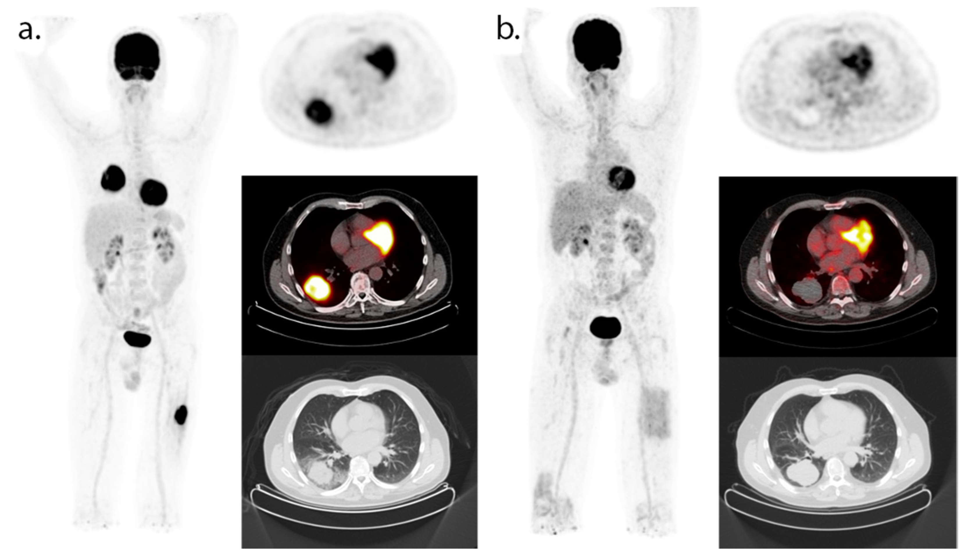 Cancers 13 03083 g002