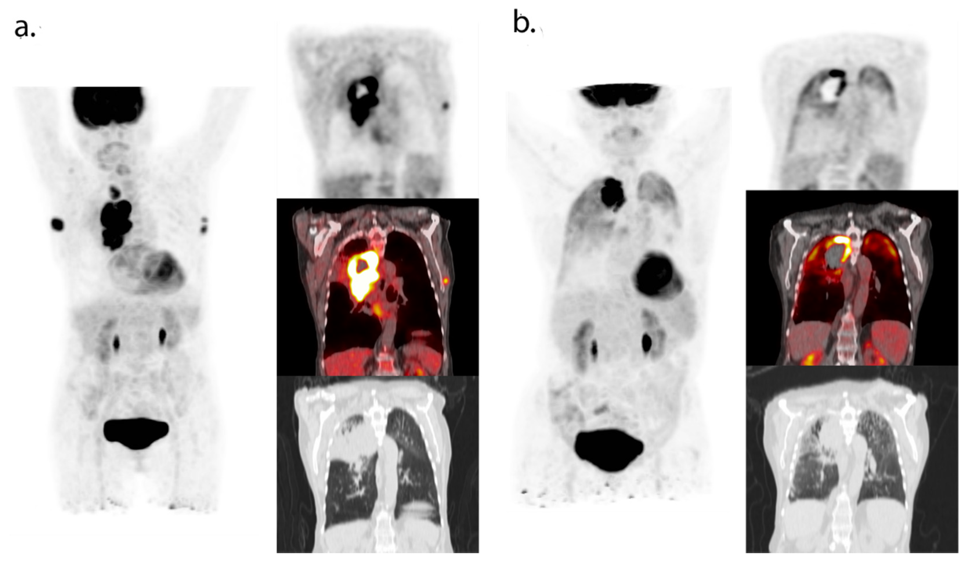 Cancers 13 03083 g003
