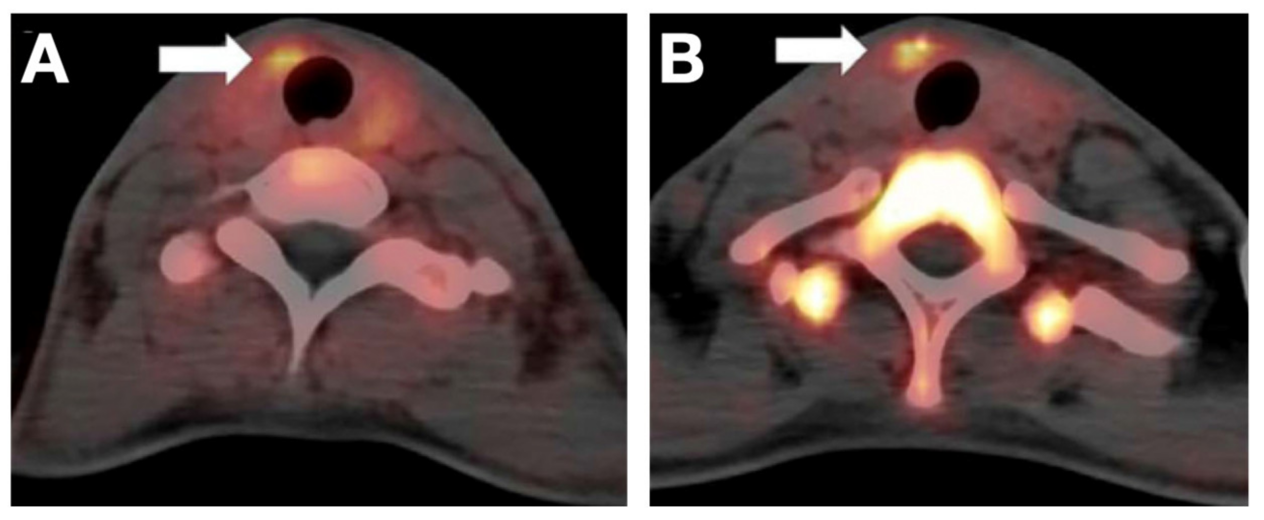 Cancers 13 03188 g004