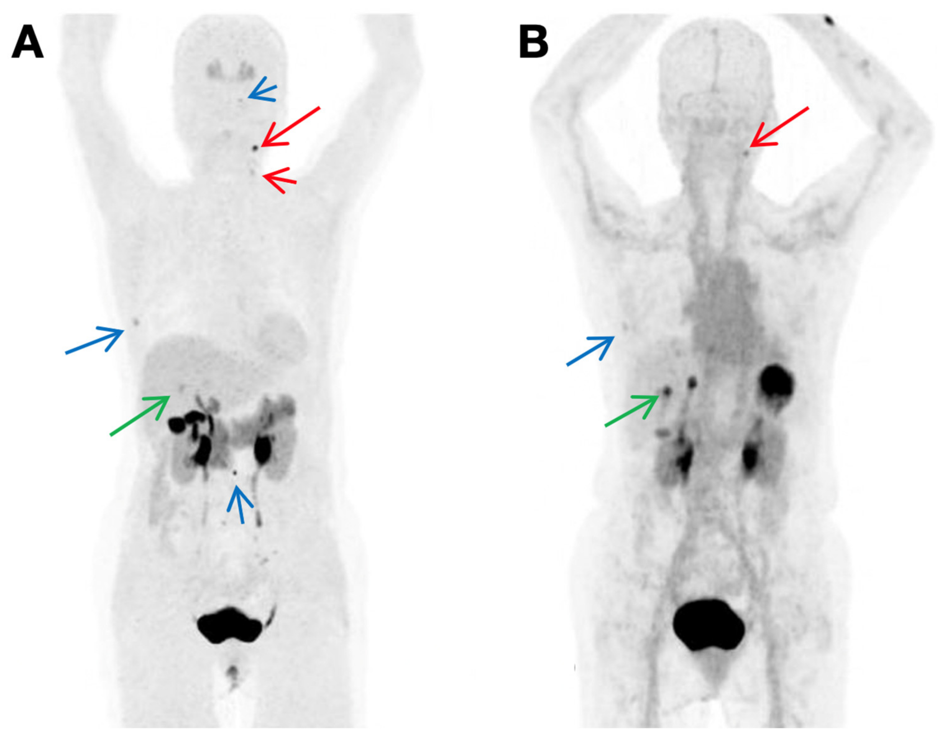 Cancers 13 03188 g007