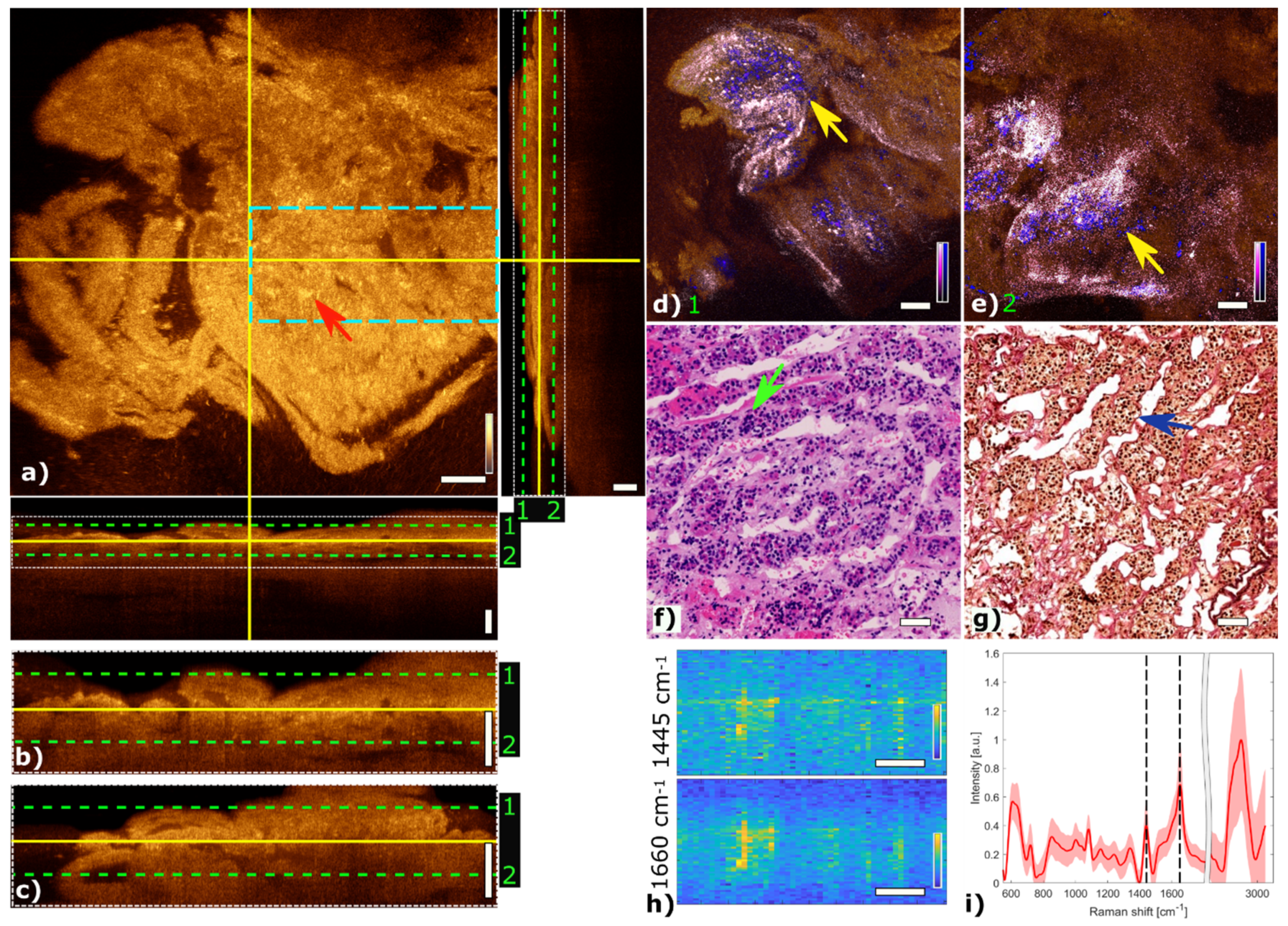 Cancers 13 03234 g003