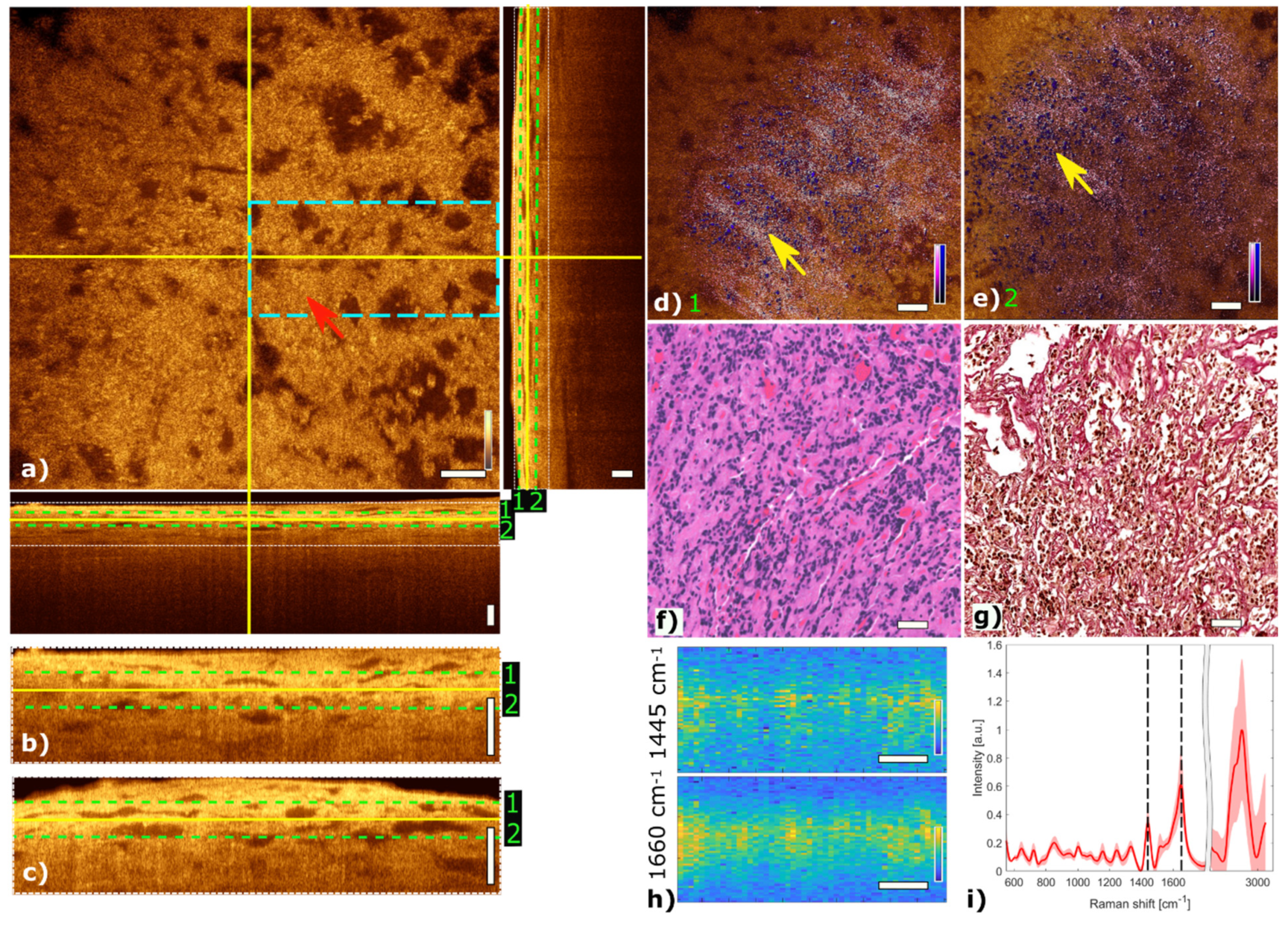 Cancers 13 03234 g004
