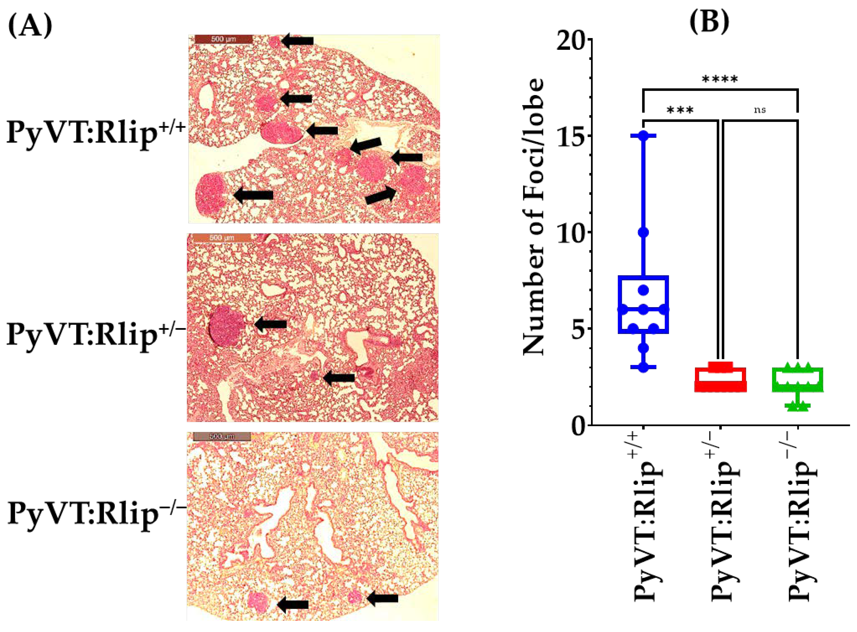 Cancers 13 03329 g005 Cancers 13 03329 g005