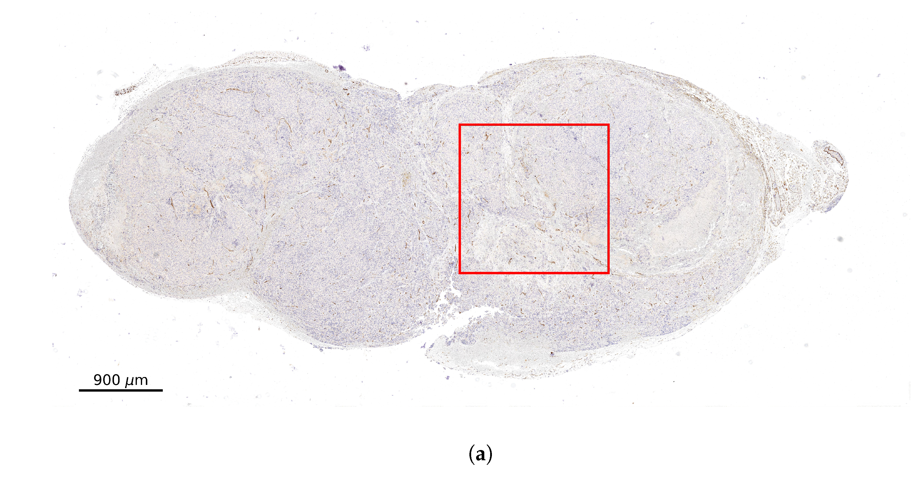 Cancers 13 03429 g001a