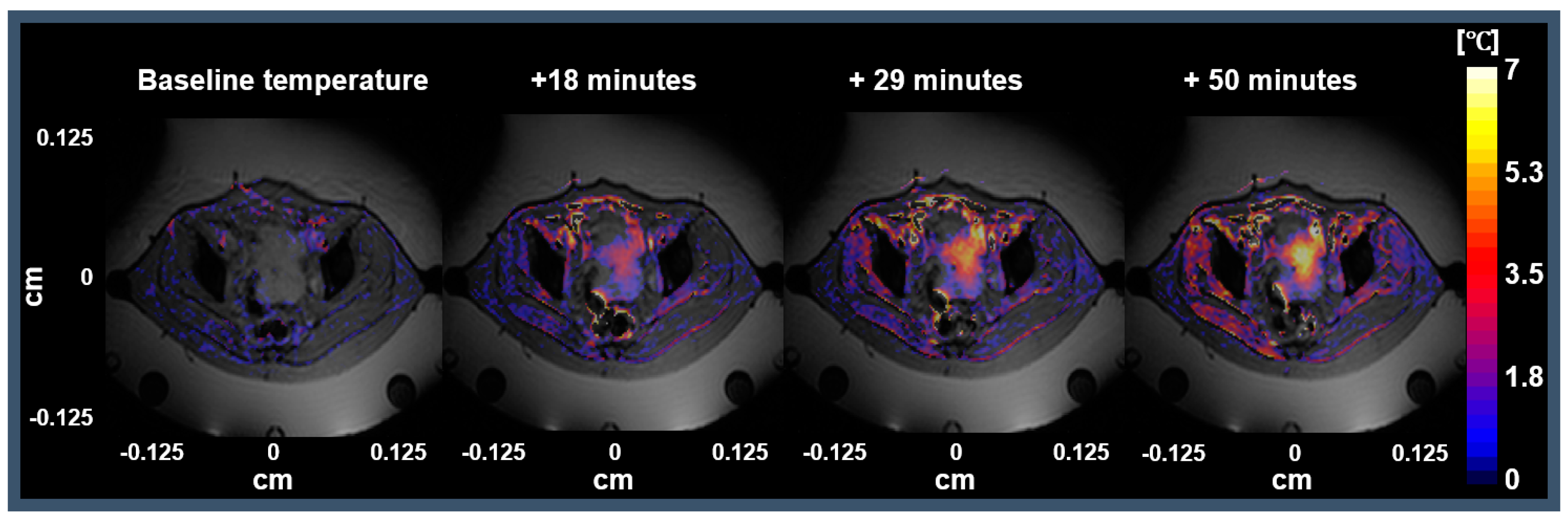 Cancers 13 03503 g005 Cancers 13 03503 g005
