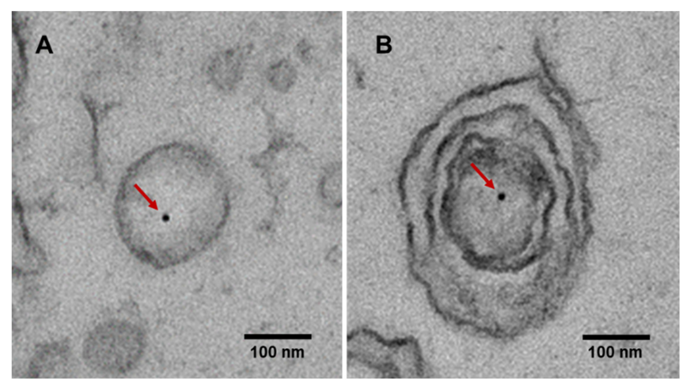 Low-coverage whole-genome sequencing of extracellular vesicle-associated  DNA in patients with metastatic cancer