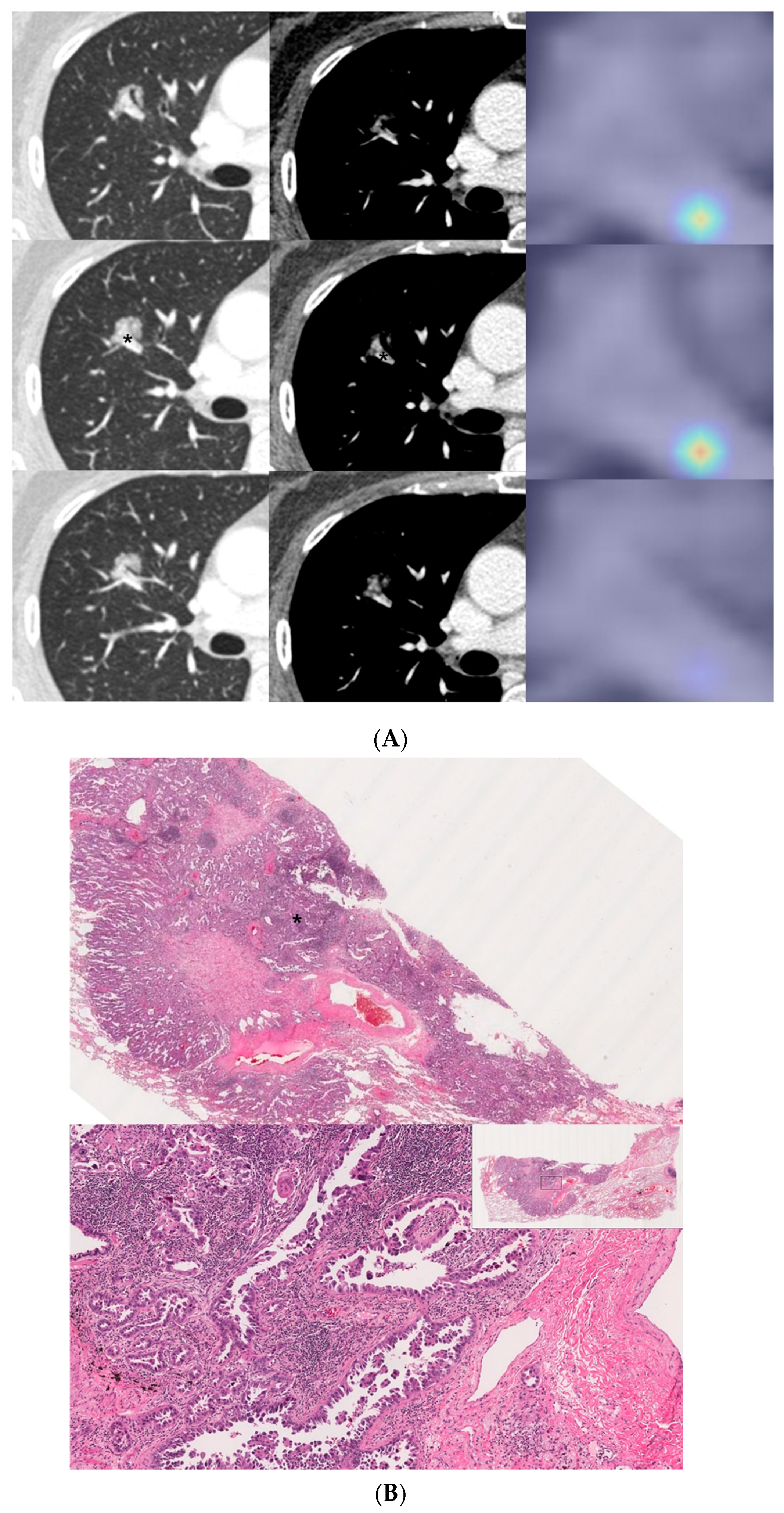 Cancers 13 04077 g004