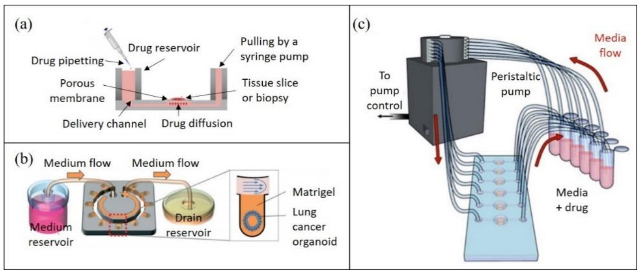 Cancers Free Full Text Technological Advances In Tumor On Chip Technology From Bench To Bedside Html