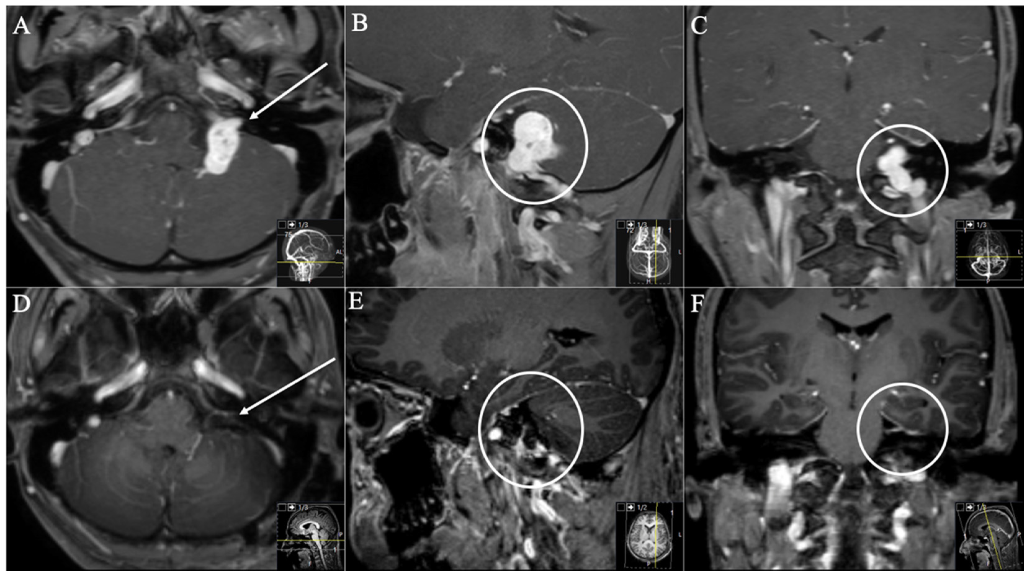 Cancers 13 04218 g004