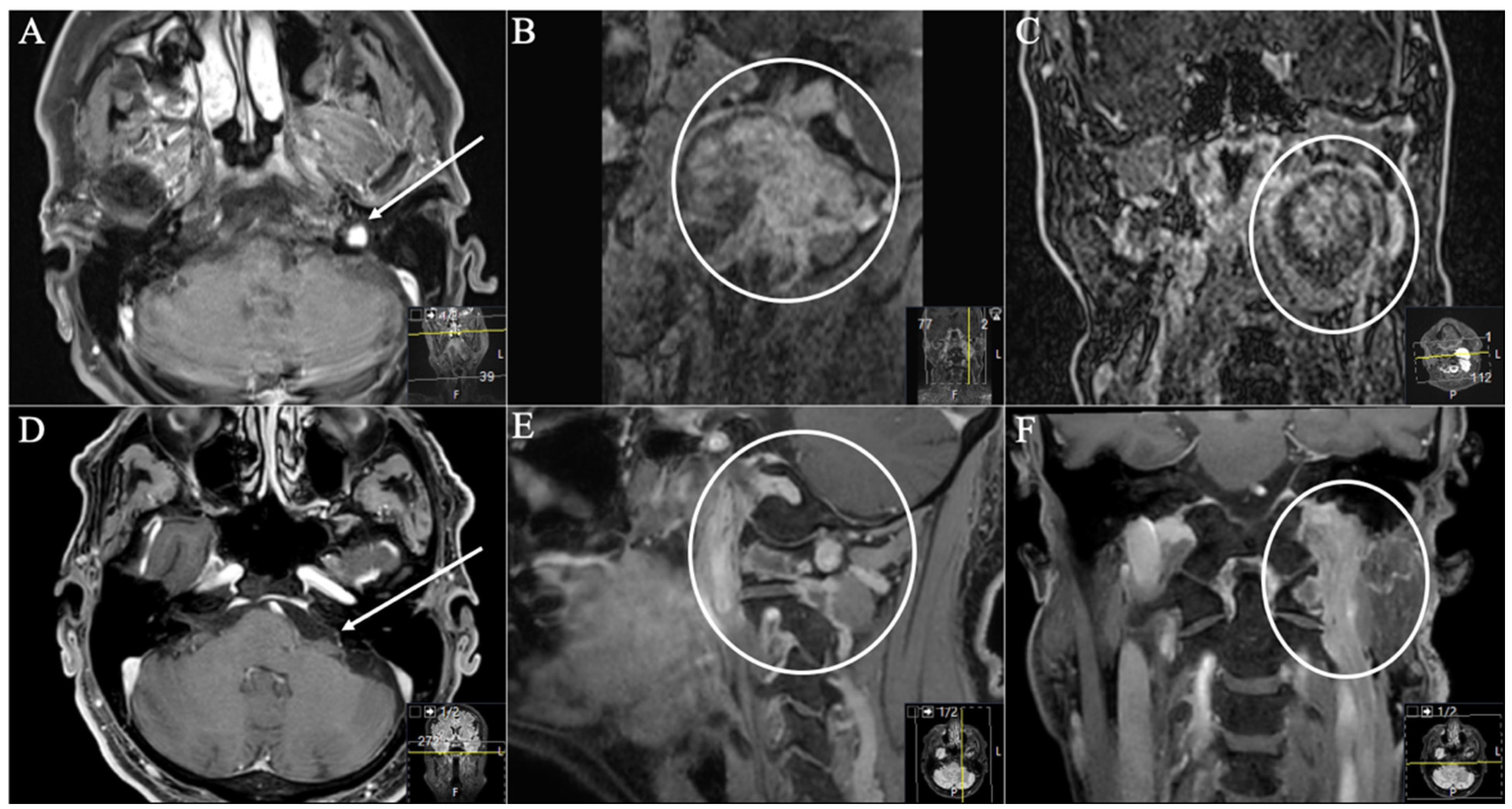 Cancers 13 04218 g005