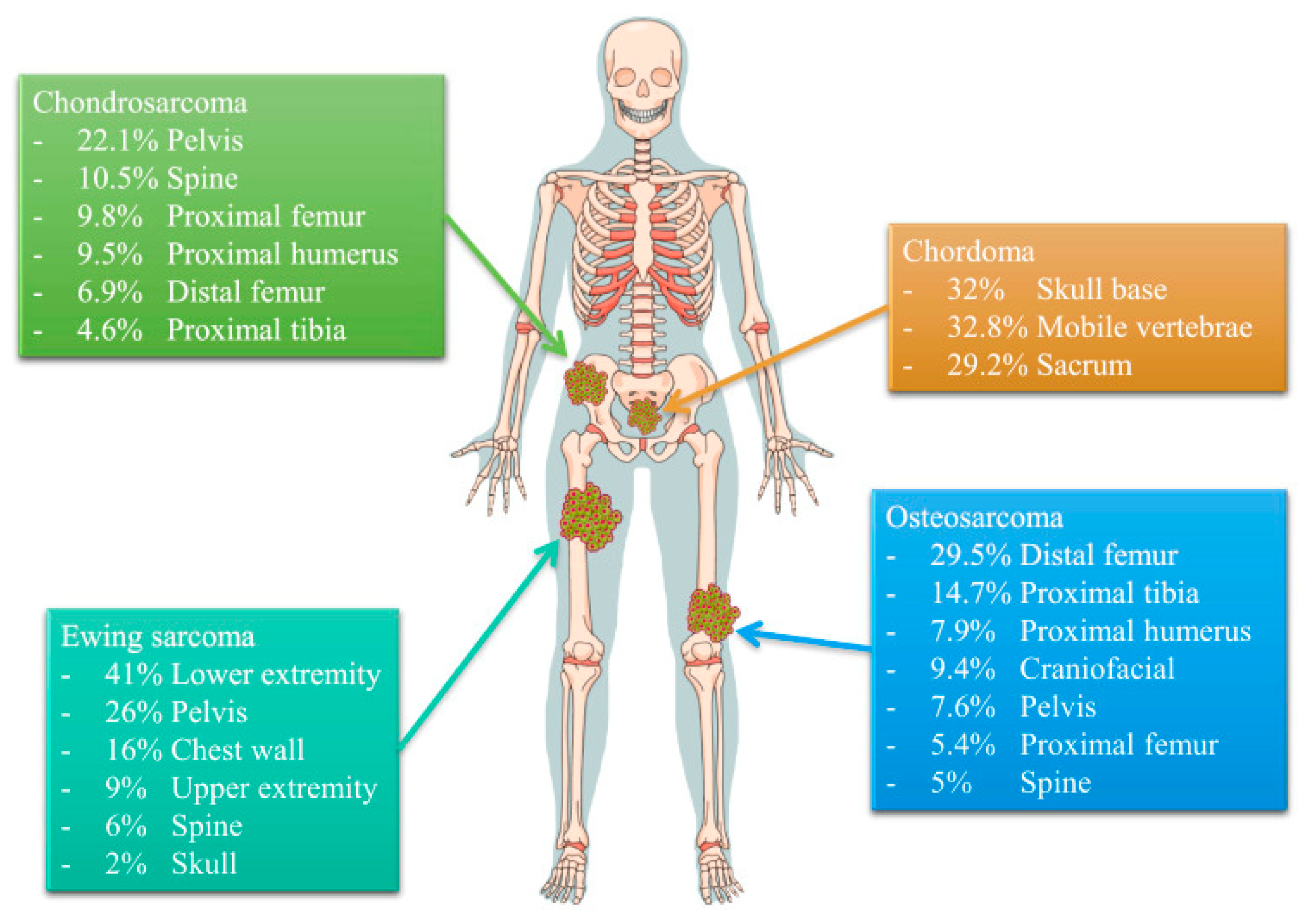 Cancers | Free Full-Text | Recent Advances in the Treatment of Bone  Metastases and Primary Bone Tumors: An Up-to-Date Review