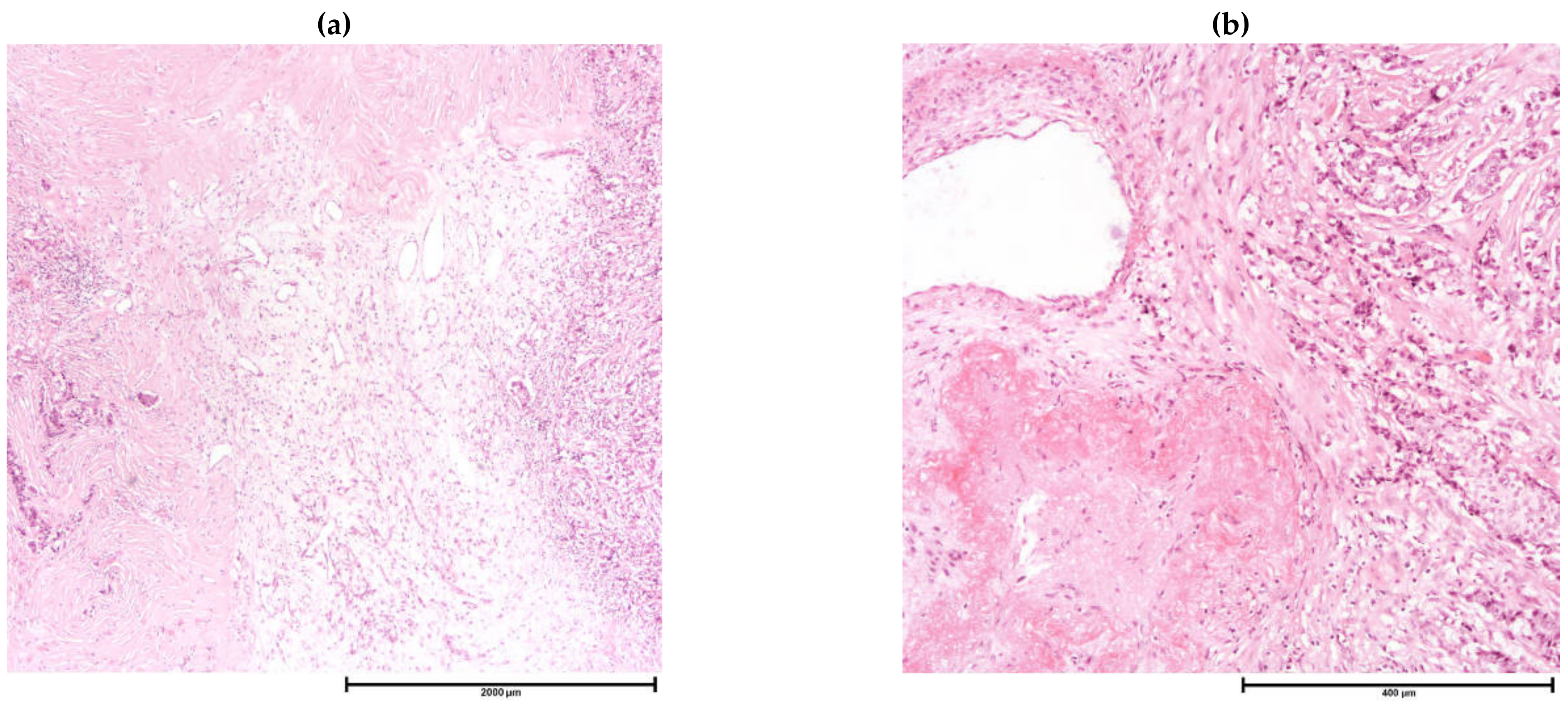 Cancers 13 04233 g003