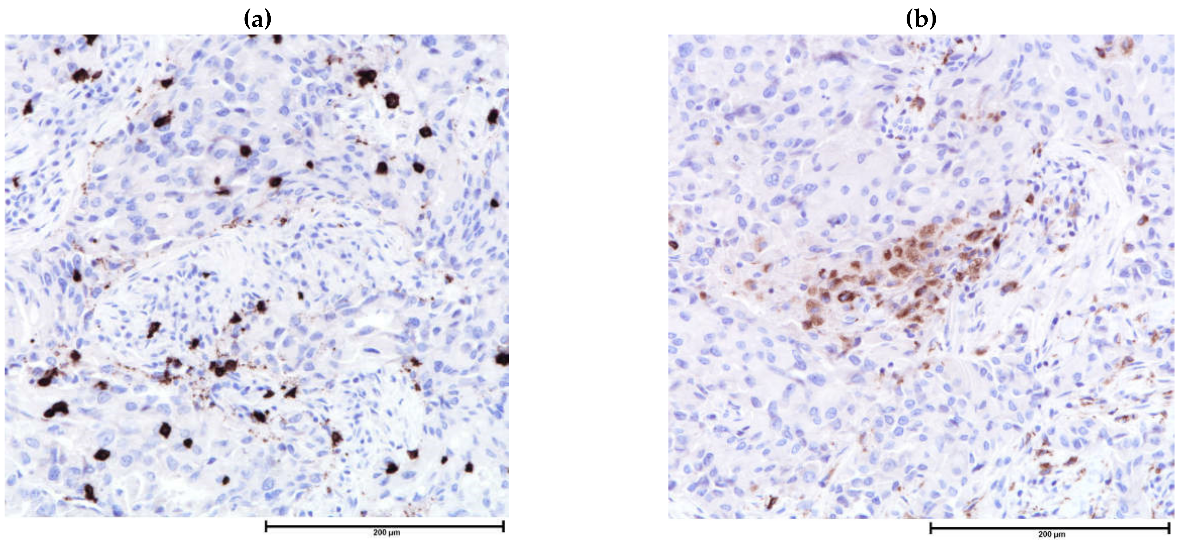 Cancers 13 04233 g004