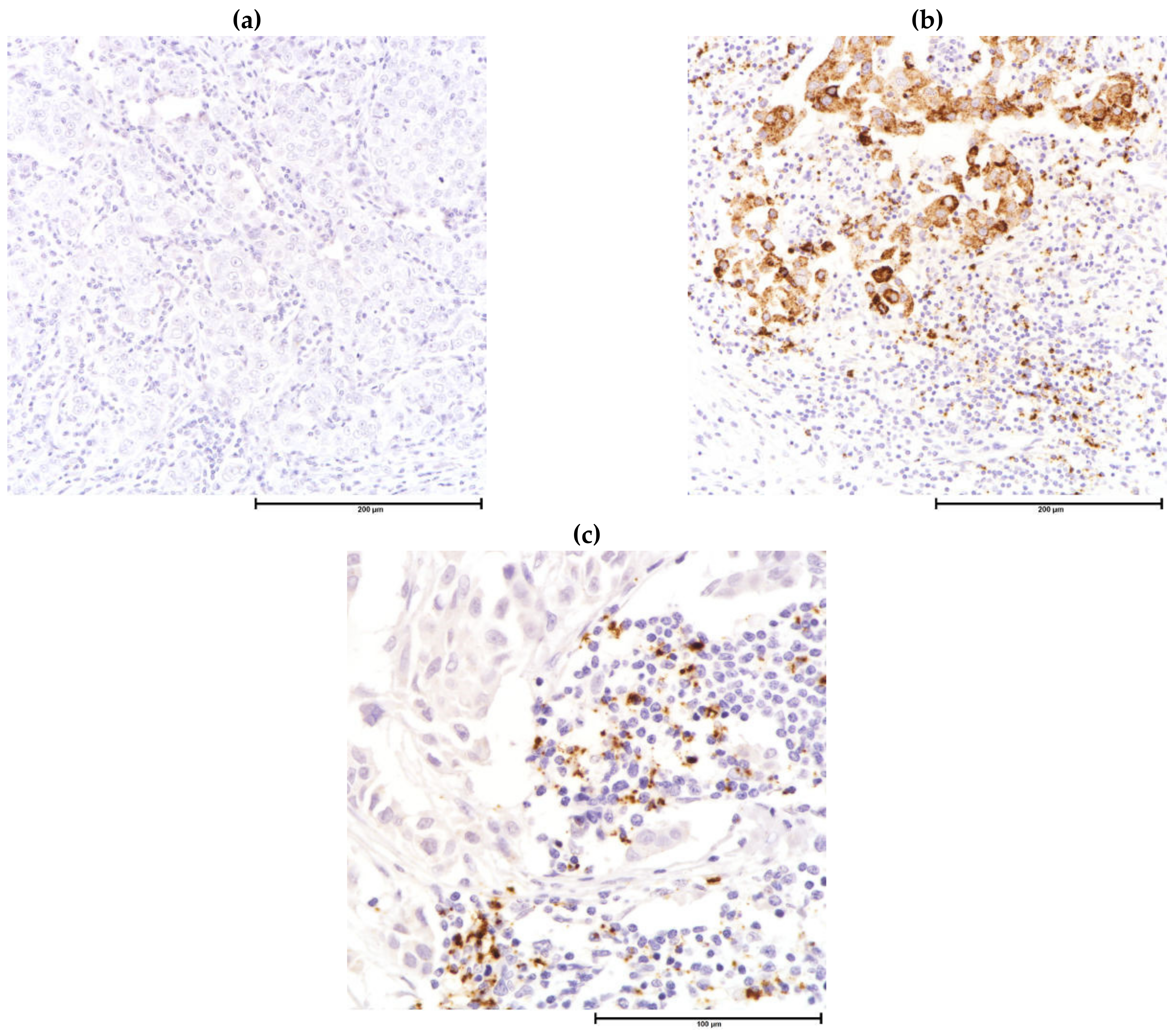 Cancers 13 04233 g005