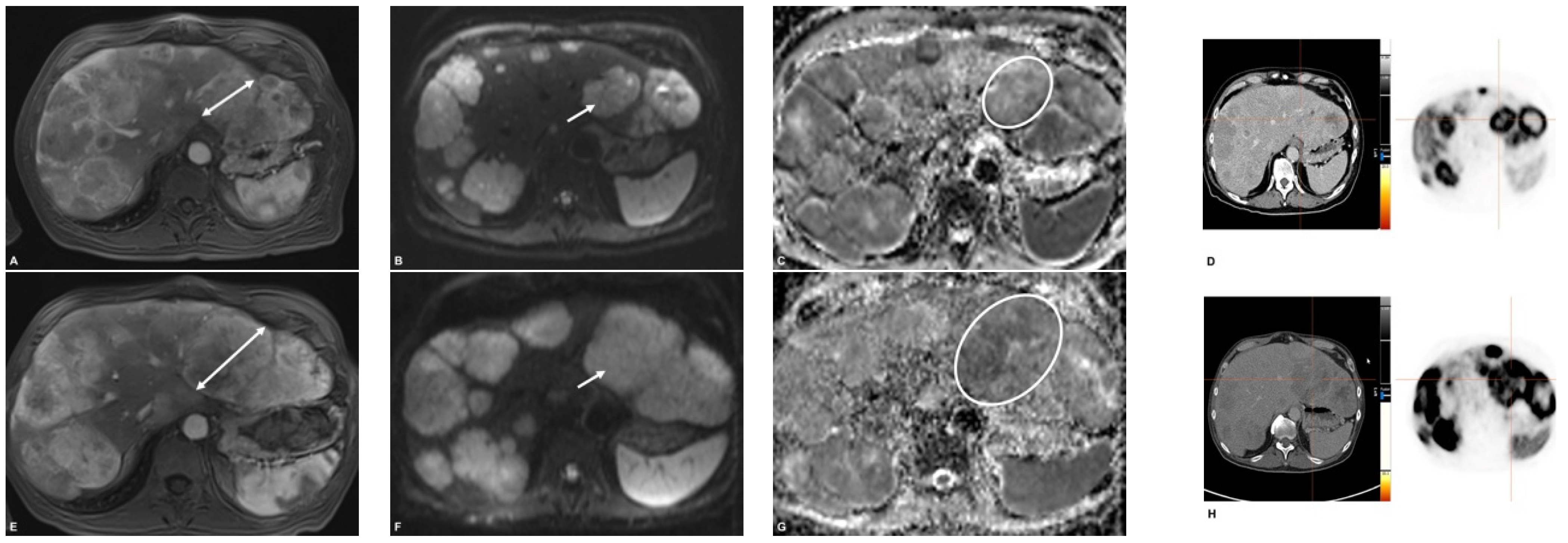 Cancers 13 04321 g002