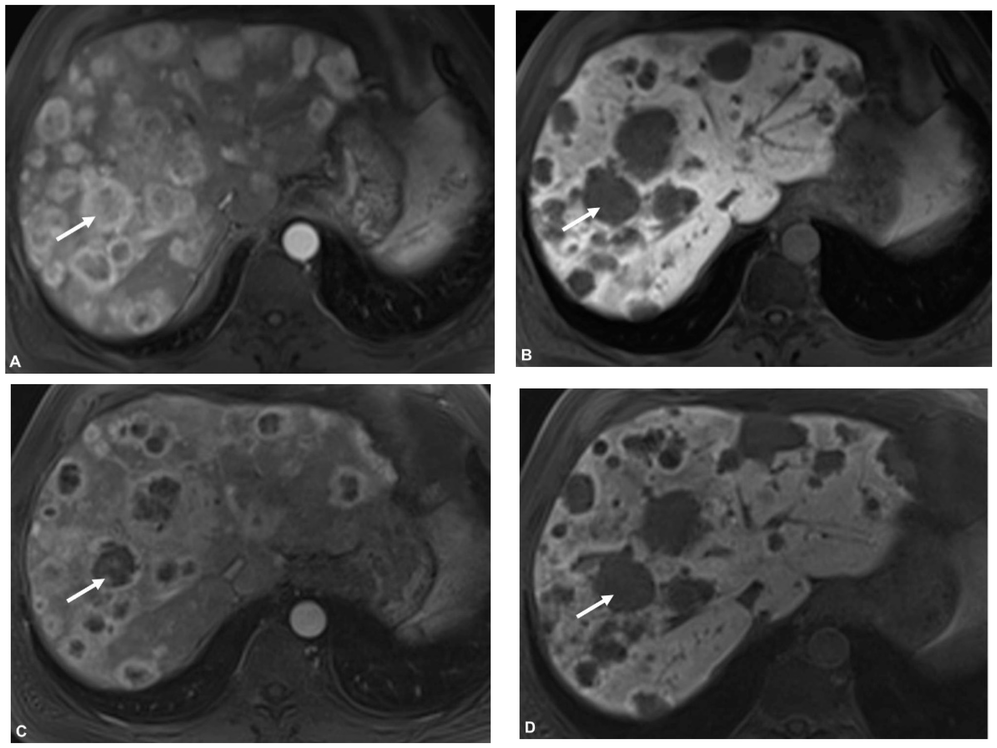 Cancers 13 04321 g003