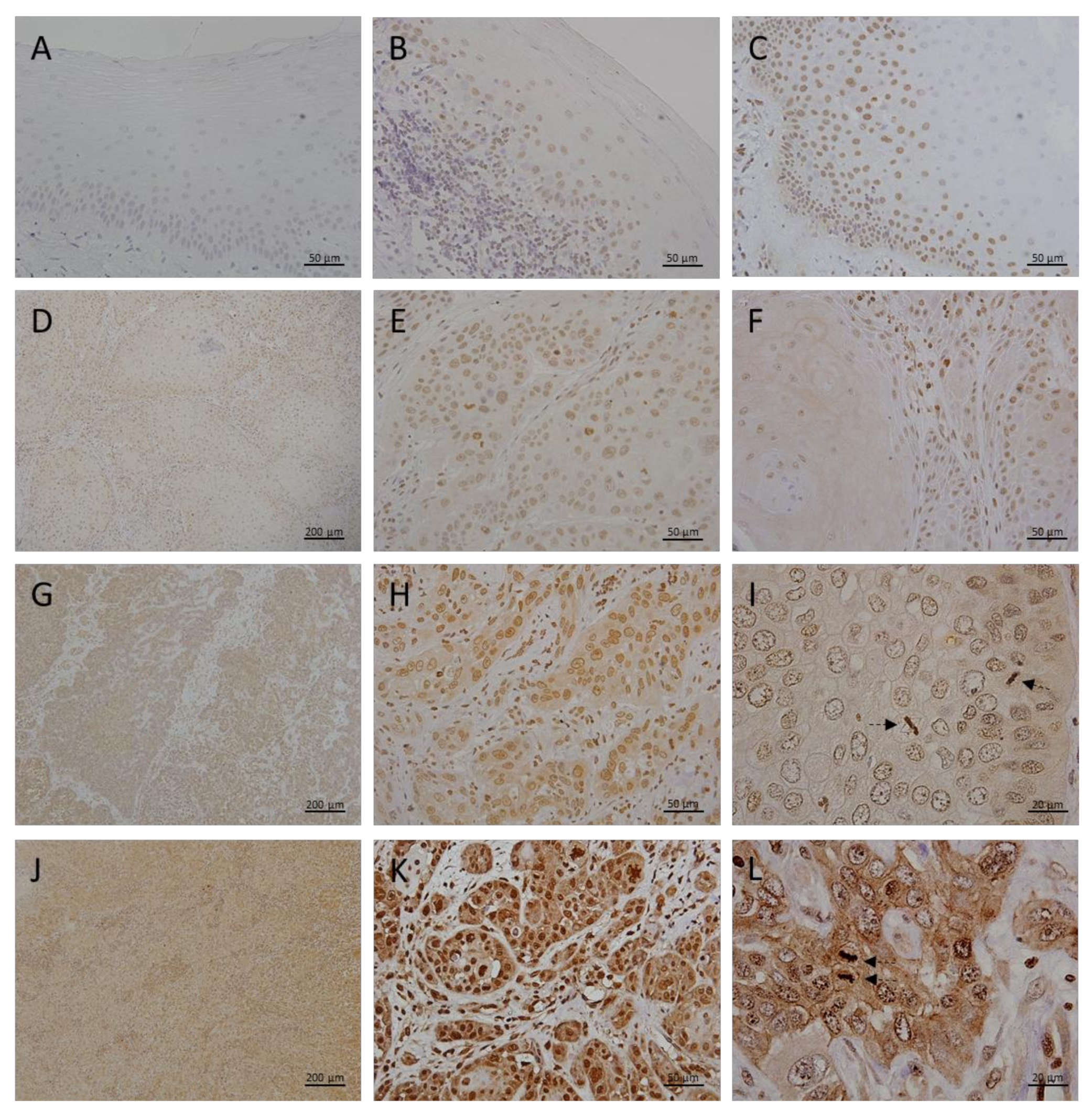 Cancers 13 04530 g003