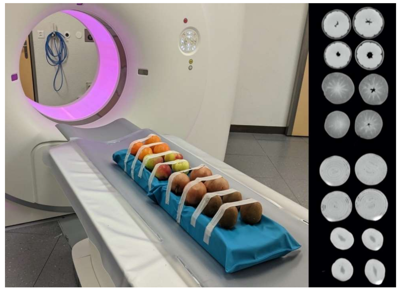 Frontiers  Dual-energy computed tomography to detect early