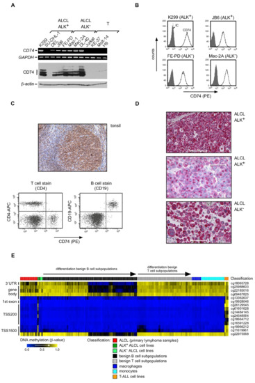 Cancers | Free Full-Text | Aberrant Expression of and Cell Death Induction  by Engagement of the MHC-II Chaperone CD74 in Anaplastic Large Cell  Lymphoma (ALCL) | HTML