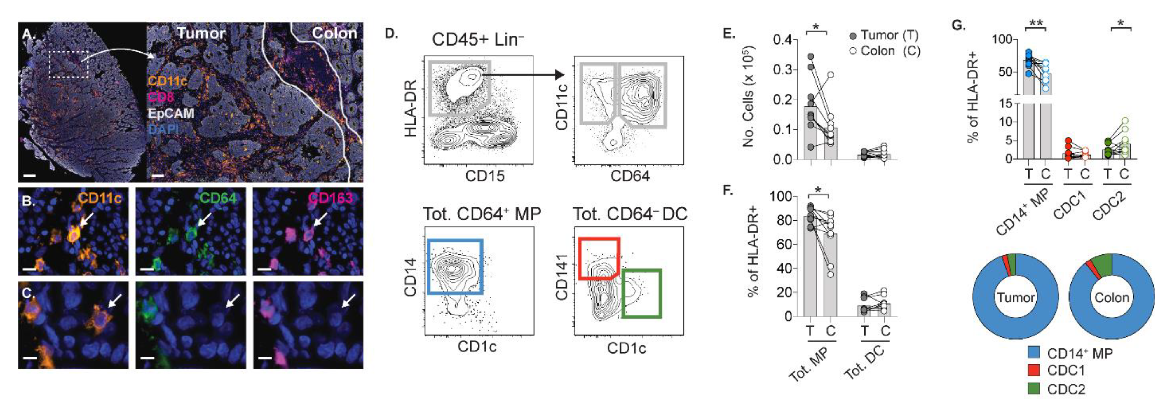 Cancers Free Full Text Antigen Presenting Cells from Tumor and