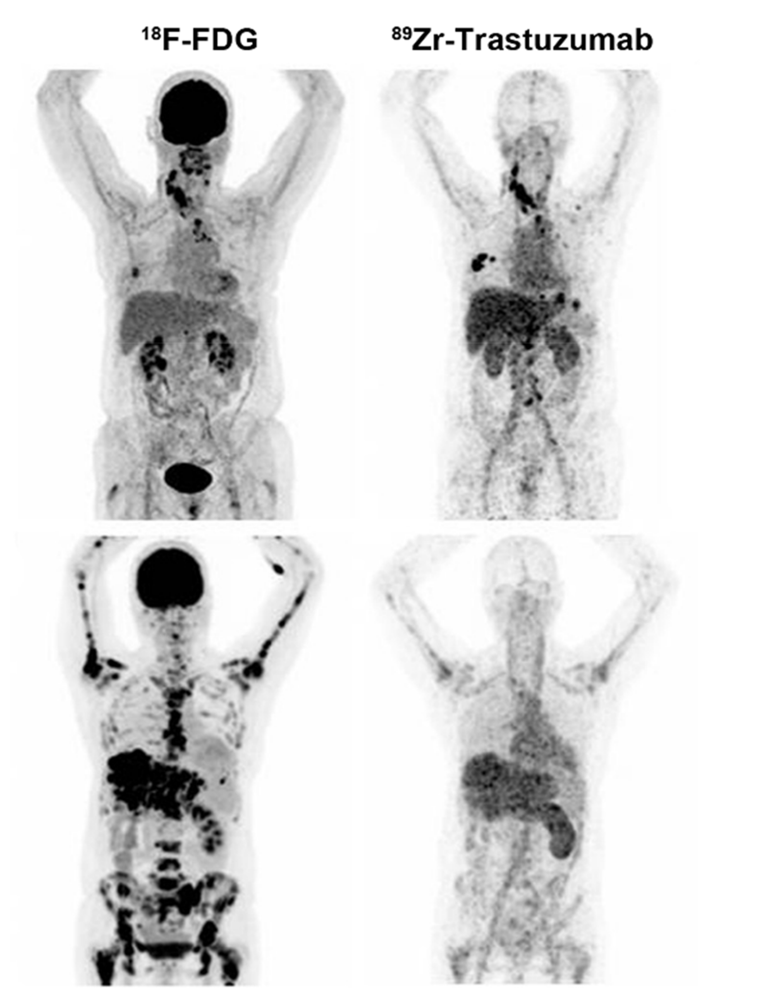 Cancers Free Full Text Radionuclide Based Imaging Of Breast Cancer