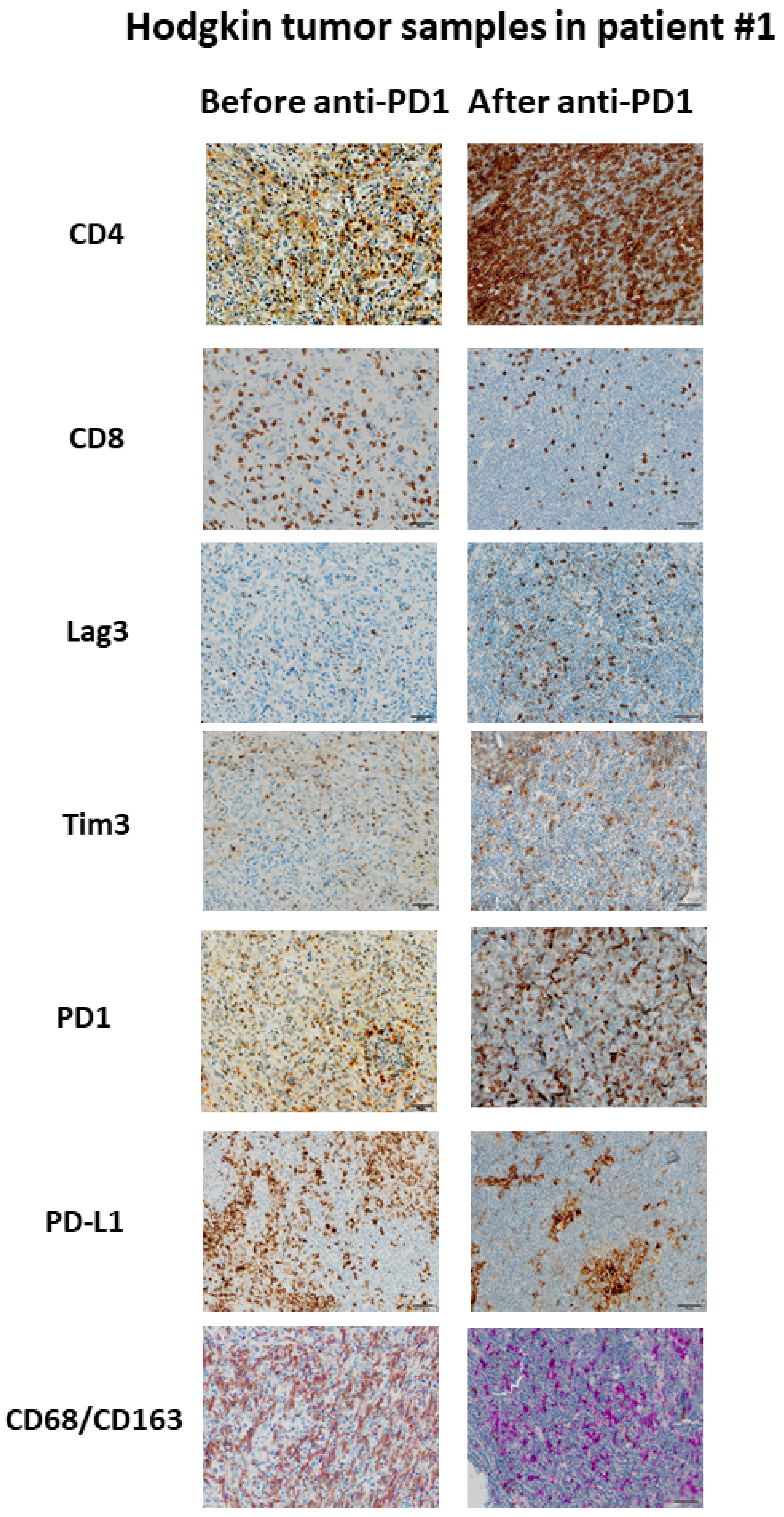 Cancers 13 05487 g003