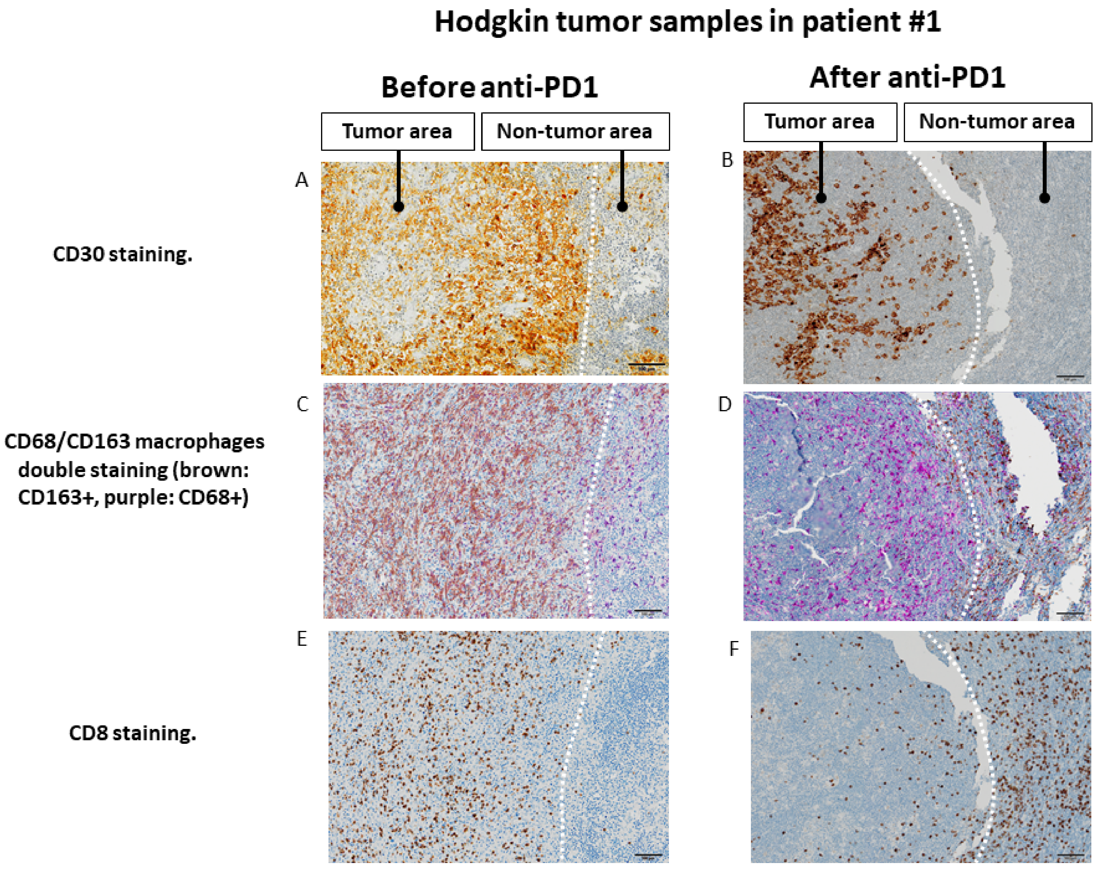 Cancers 13 05487 g004