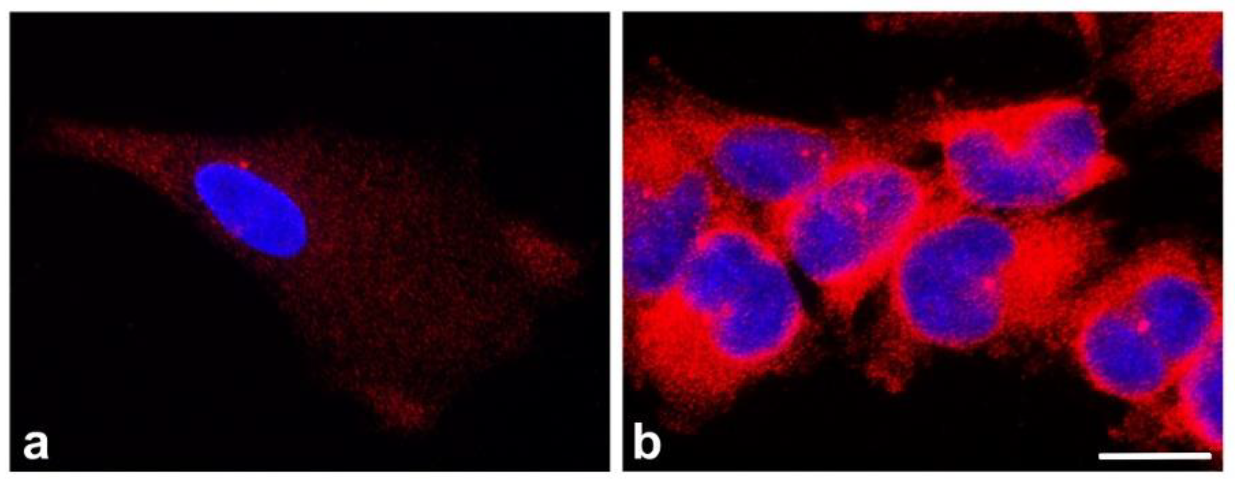 Cancers 13 05638 g003 Cancers 13 05638 g003