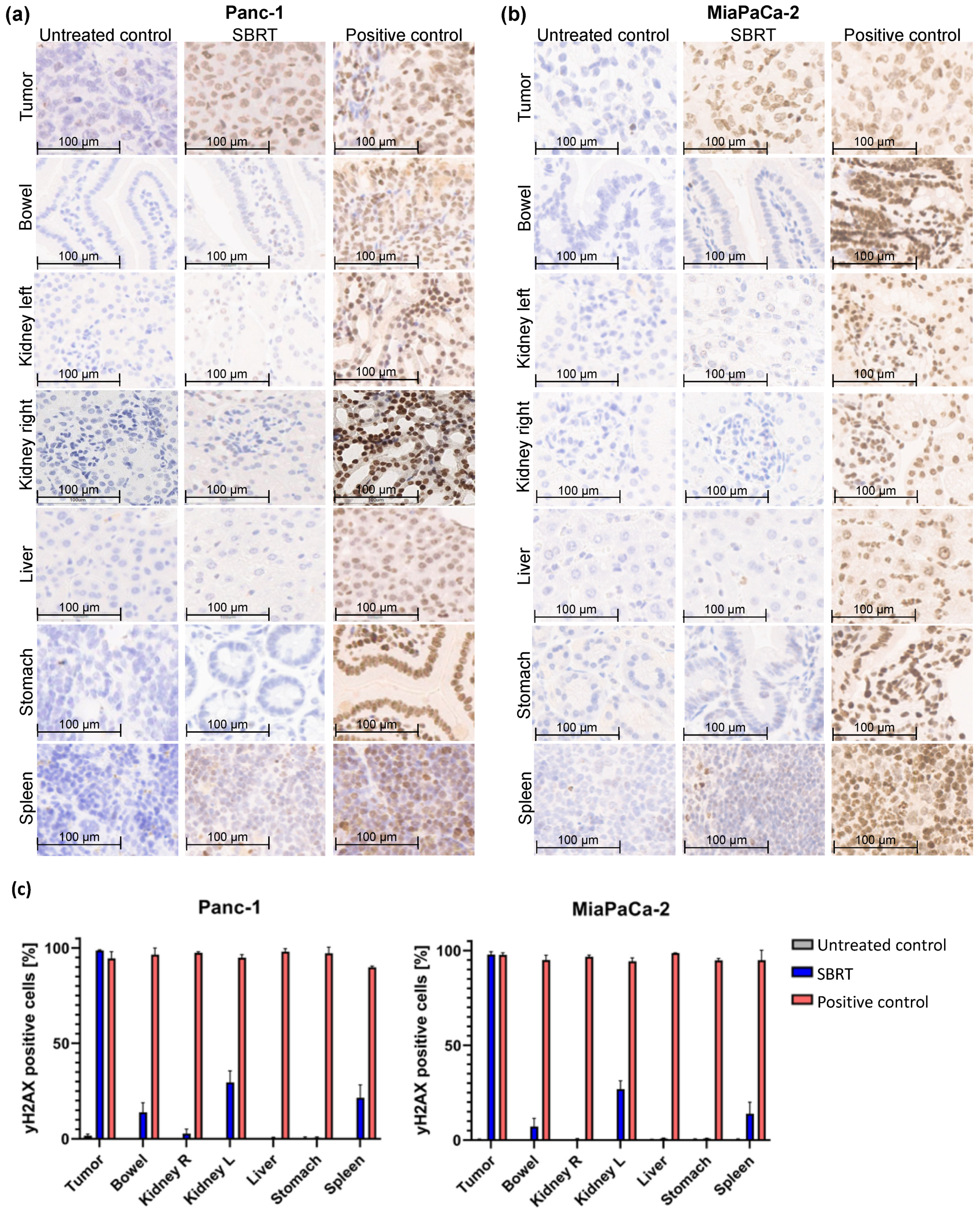 Cancers 13 05656 g002